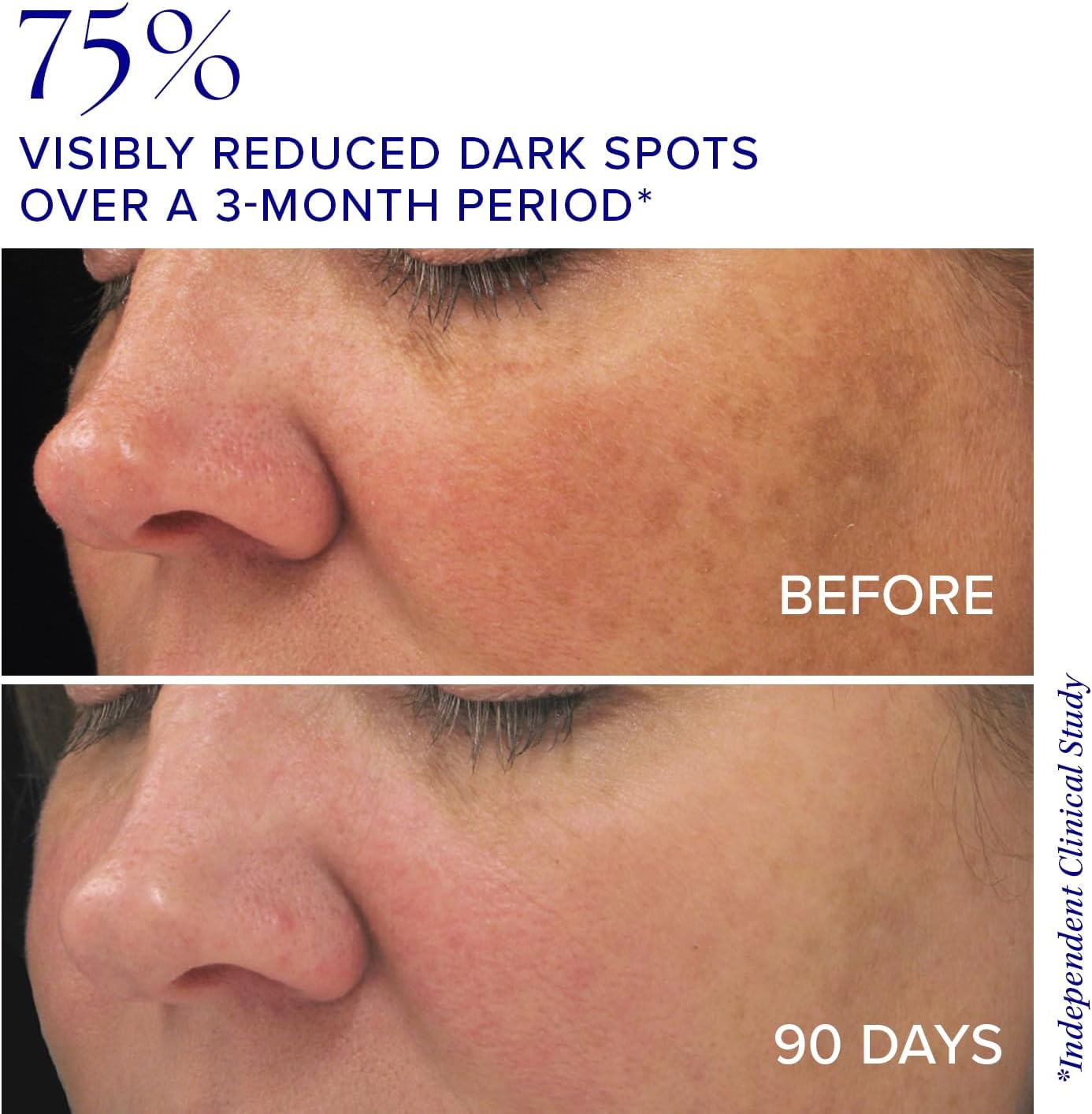 Is CLINICAL - White Lightening Complex (30Ml) image number 1