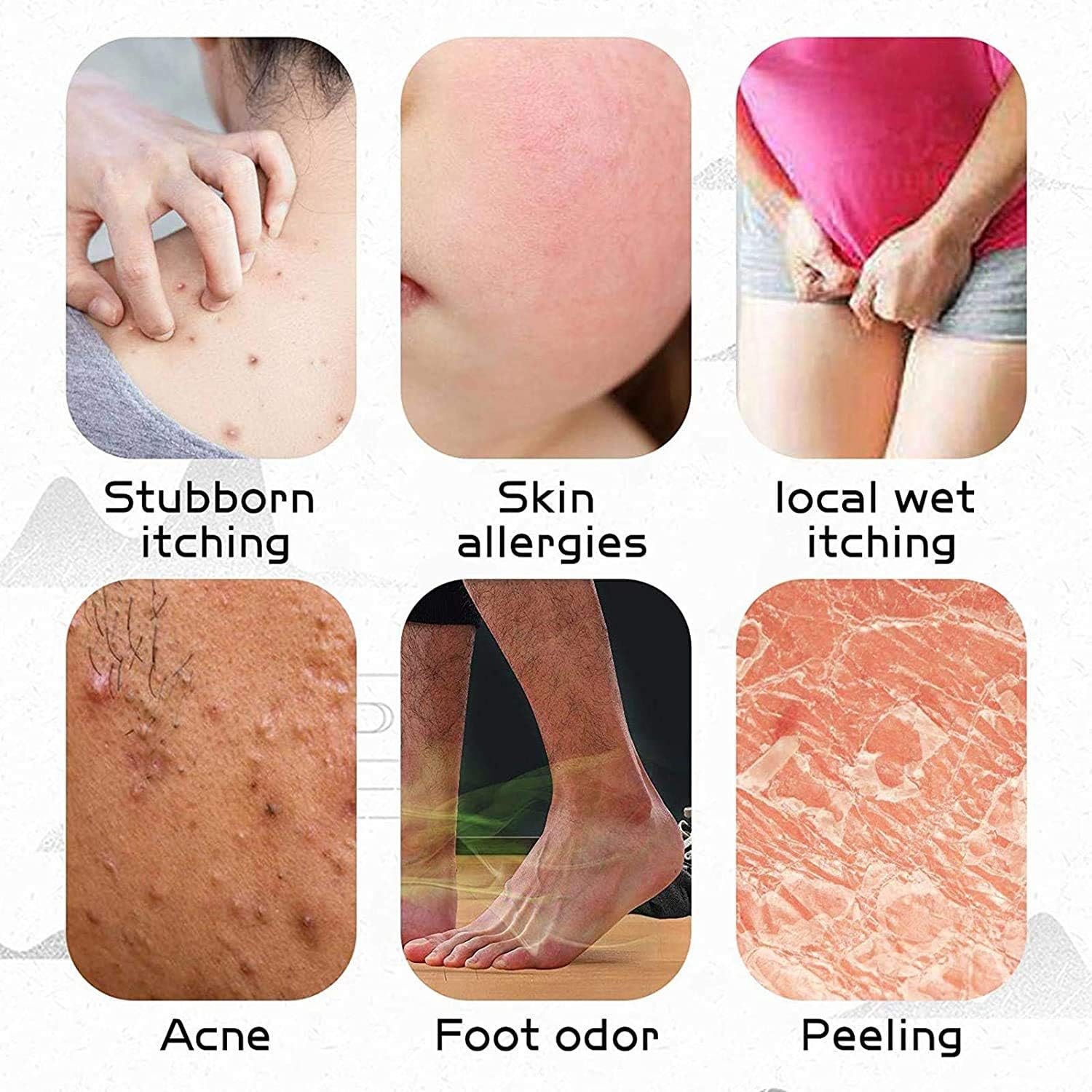 Chinese Herbal Eczema Cream, Anti-Itch Cream, Psoriasis Creams, Dermatitis and Eczema Pruritus Psoriasis, Natural Herbal Chinese Eczema Cream for Adults Kids (4PCS) image number 1