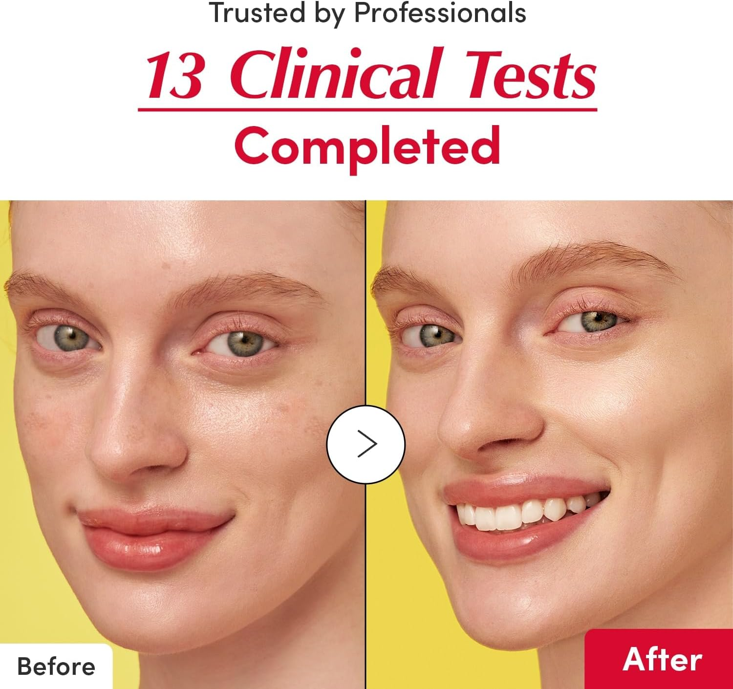 EQQUALBERRY Vitamin Illuminating Serum &ndash; Brightening Vitamin C Serum with Niacinamide | Strengthens Skin Barrier | Hydrates Using Ceramide and Hyaluronic Acid, 1.01Oz / 30Ml image number 5