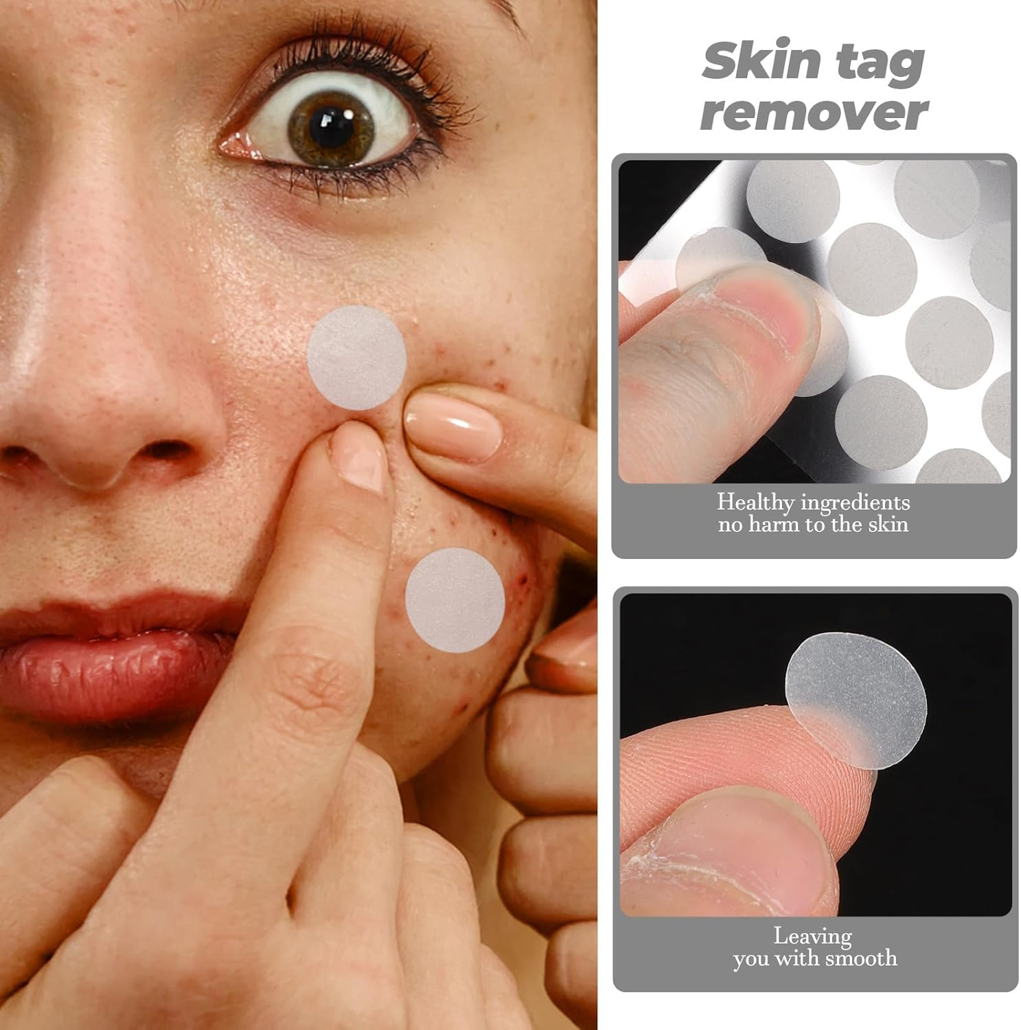 480 Pcs Mole Patch Stickers Labels Remover Patch Mole Remove Patch Wart Skin Patches Face Patches Facial Mole Patches Skin Patches Accessories Glue Peeled