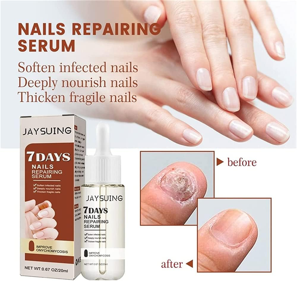 7 Days Nail Growth and Strengthening Serum, 20Ml Nail Growth and Strength Serum, Nail Growth & Strengthening Oil Serum, Stronger Nails in 1 Week Nail Strengthening Treatment (1Pcs) - 1Pcs image number 3