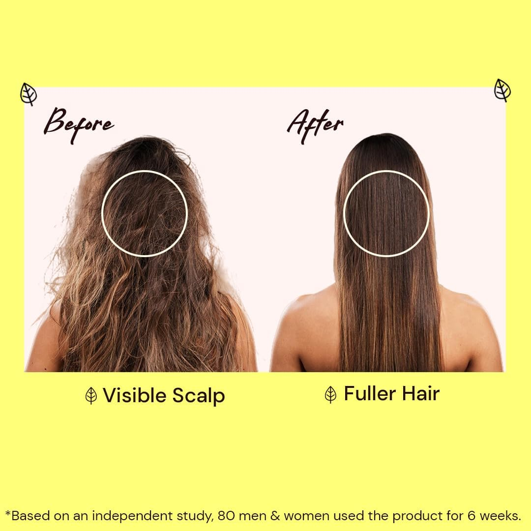 Atulya Amla & Bhringraj Hair Shampoo - Sulphate & Paraben Free (100% Natural) | Herbal Shampoo, Hair Growth & Hair Fall Control, Dandruff Control Shampoo - 300Ml image number 1