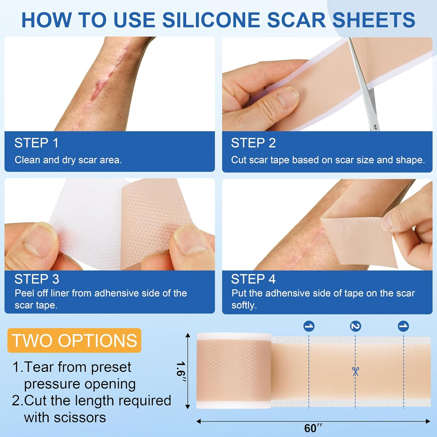 Silicone Scar Sheets - Silicone Scar Tape (1.6"X 60" Roll-150Cm) for Surgical Scars, C-Section, Keloid Scars, Hypertrophic Scars | Reusable Scar Strips image number 6