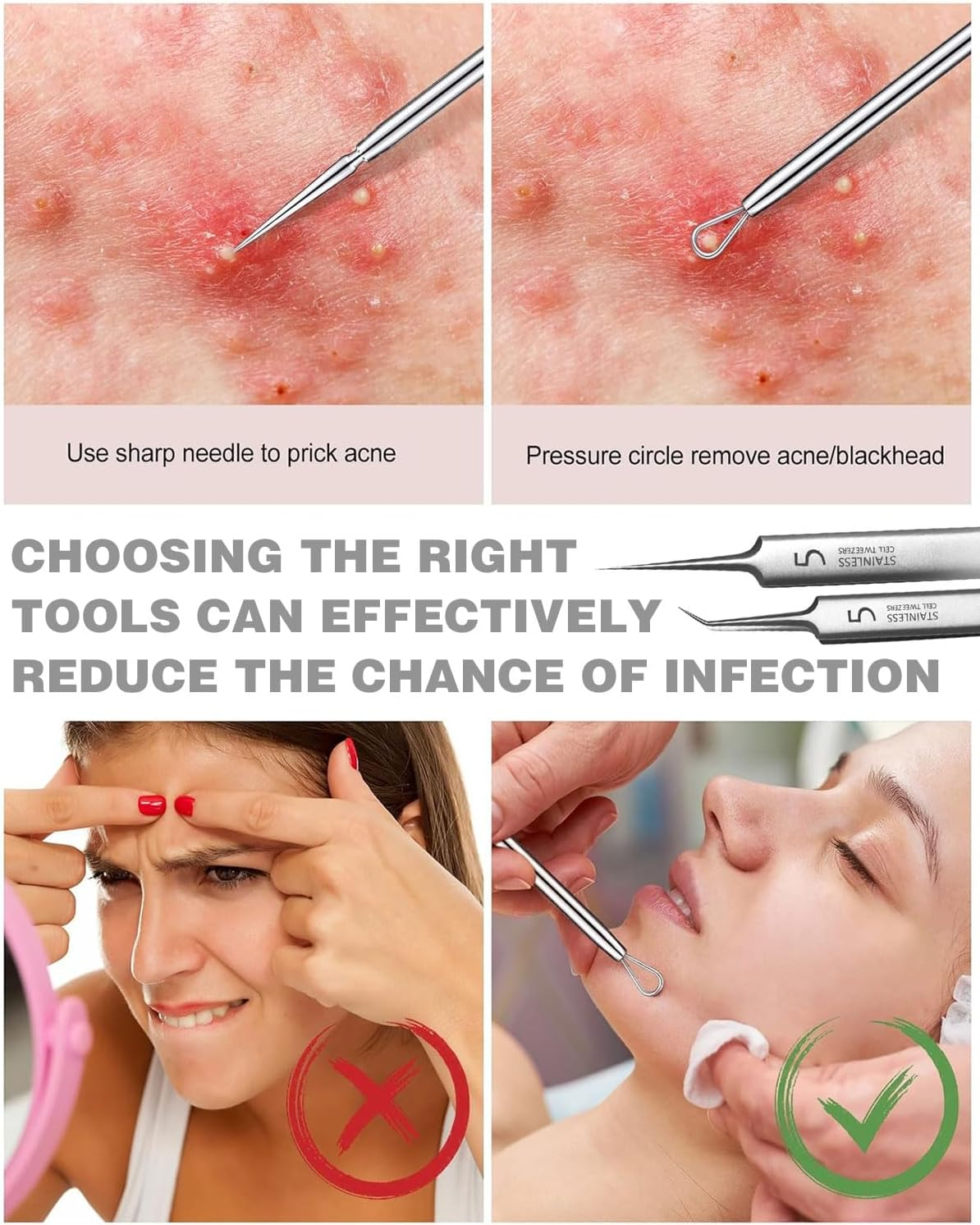 KGDUYC 6 Pieces Stainless Steel Tweezers, Milia Knife, Blackhead Tweezers, Precision Blackhead Tweezers, Fine Technical Tweezers, Splinter Tweezers for Extractor, Acne, Pimples, Comedones, Stains Or