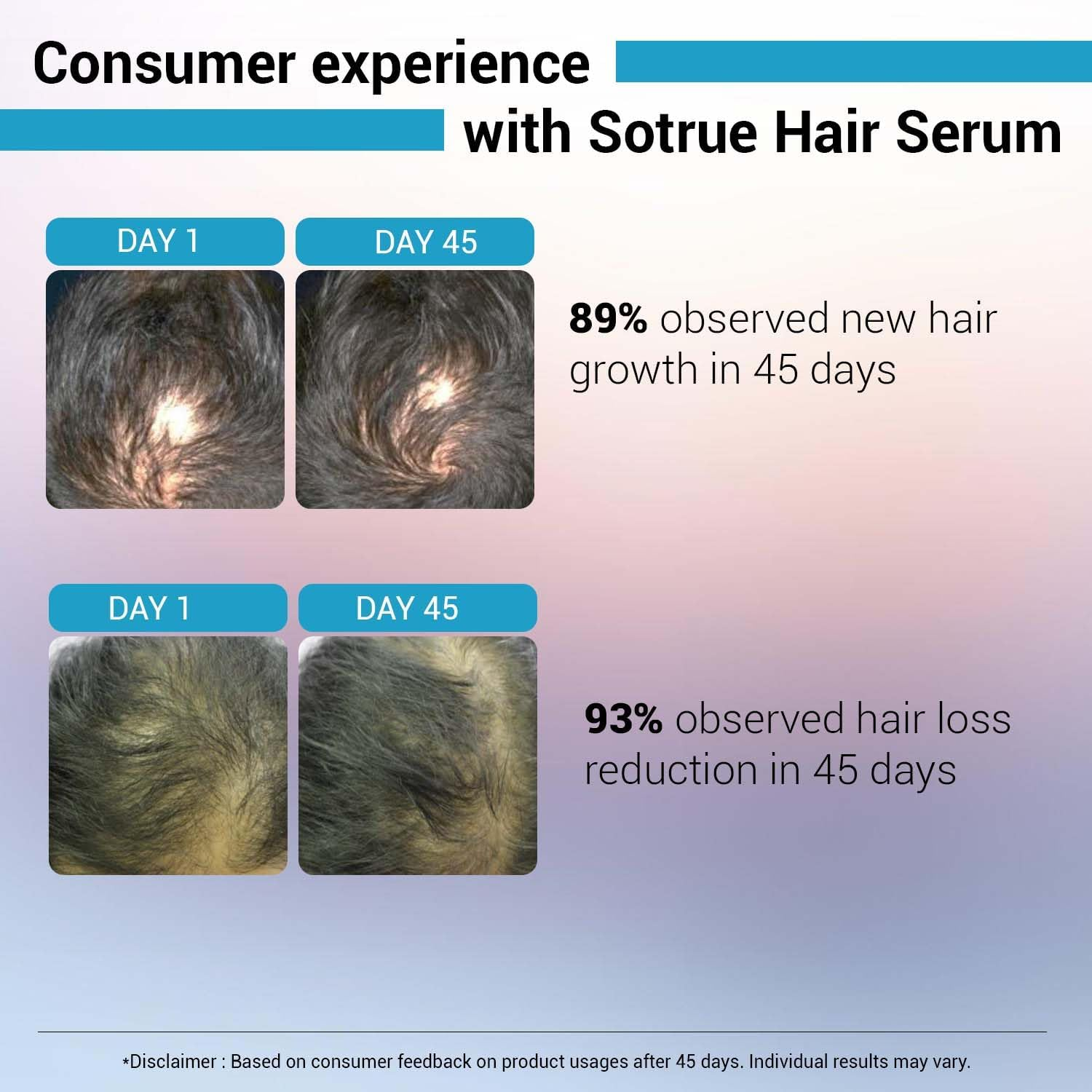 Sotrue Hair Growth Serum with Redensyl 3%, Procapil 3%, Anagain 4% and Baicapil 2% Hair Growth Actives, Stimulates Hair Growth, Hair Fall Control Serum for Women Men, for All Hair Types, 30Ml image number 1