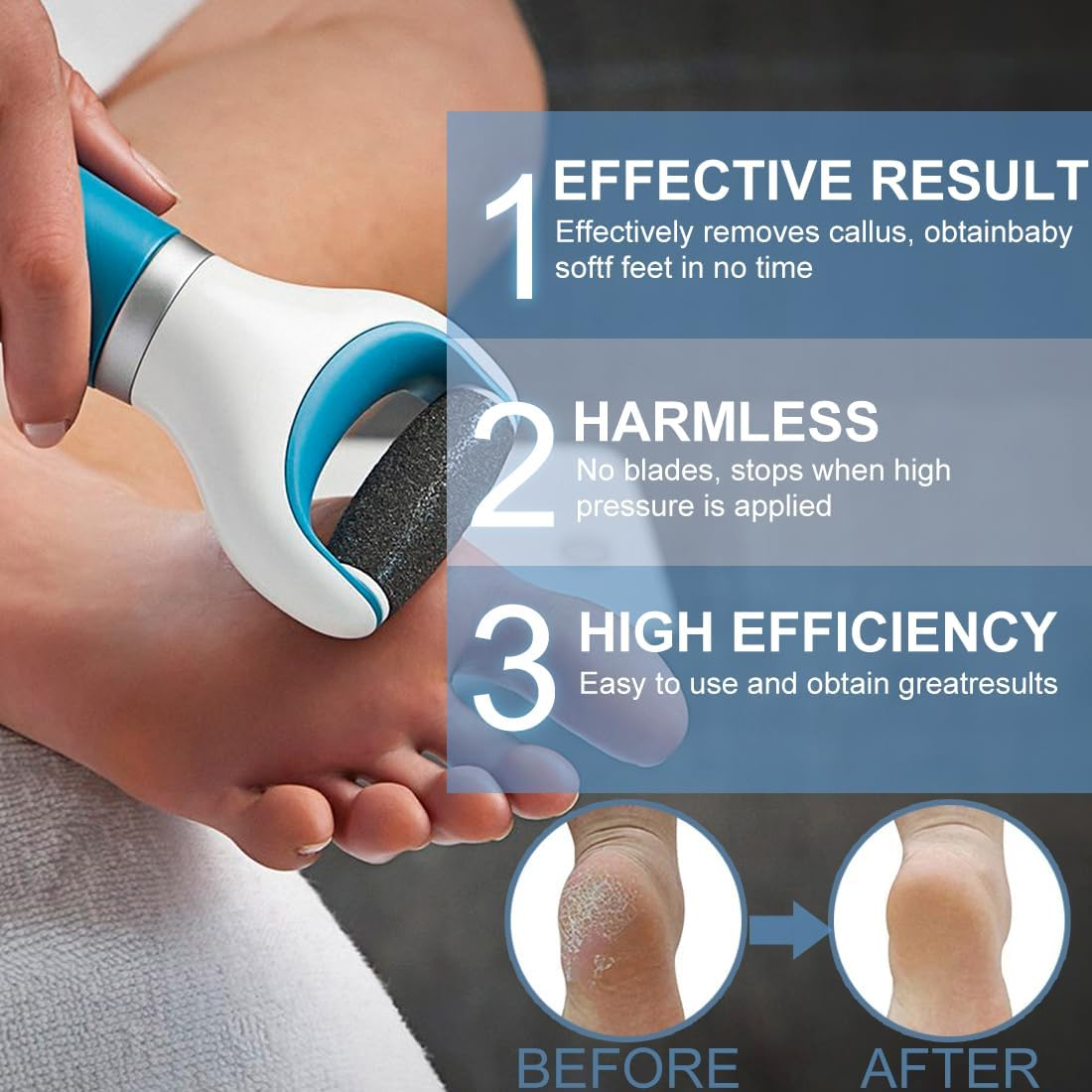 EYVRPAU 12 Pack Replacement Foot Scrubber Head Rollers 3 Roughness Pedicure Roller Callus Remover image number 2