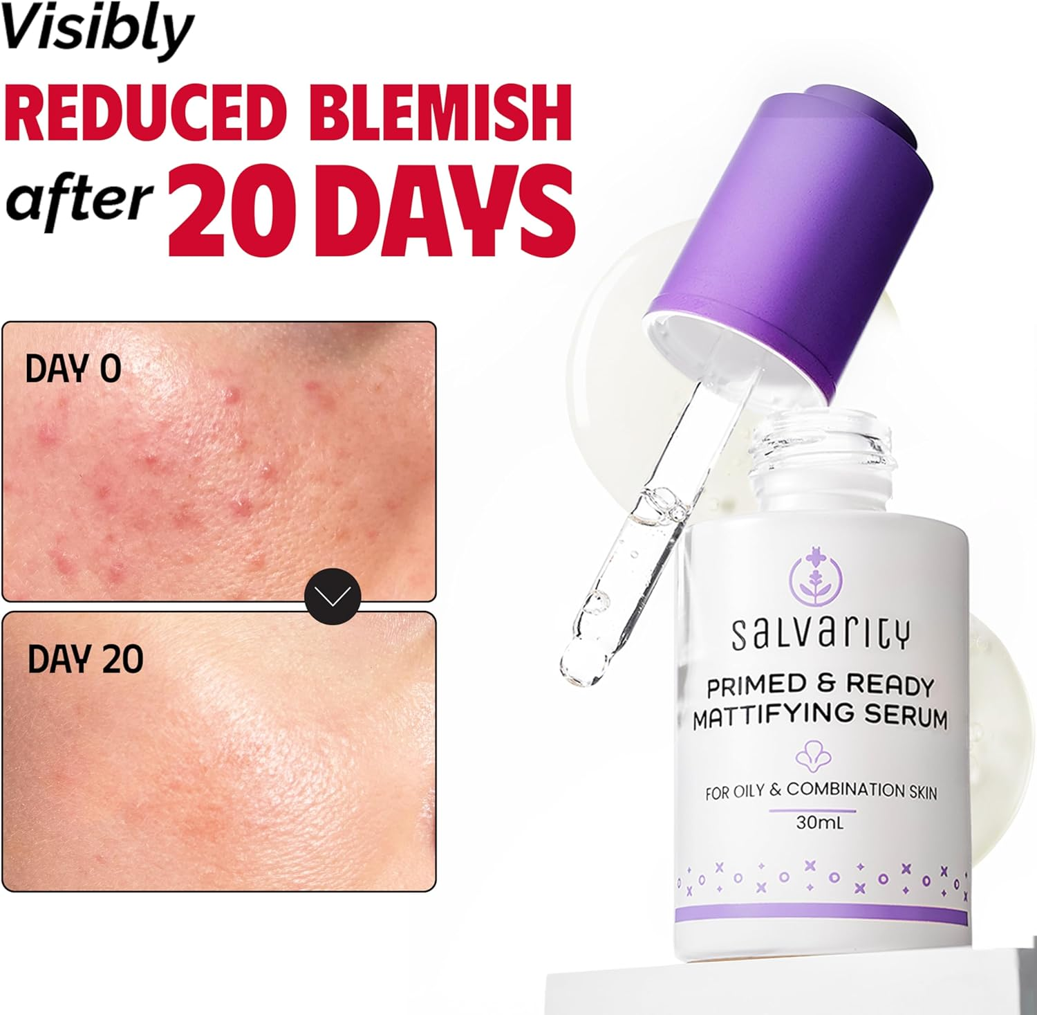 Salvarity Acne Face Serum with 2% Salicylic Acid and 5% Bamboo Extract Helps Unclog Pores and Reduce Blackheads, for Oily & Blemish-Prone Skin, Lightweight Non-Greasy Texture, Australian Made &ndash; 30 Ml image number 6