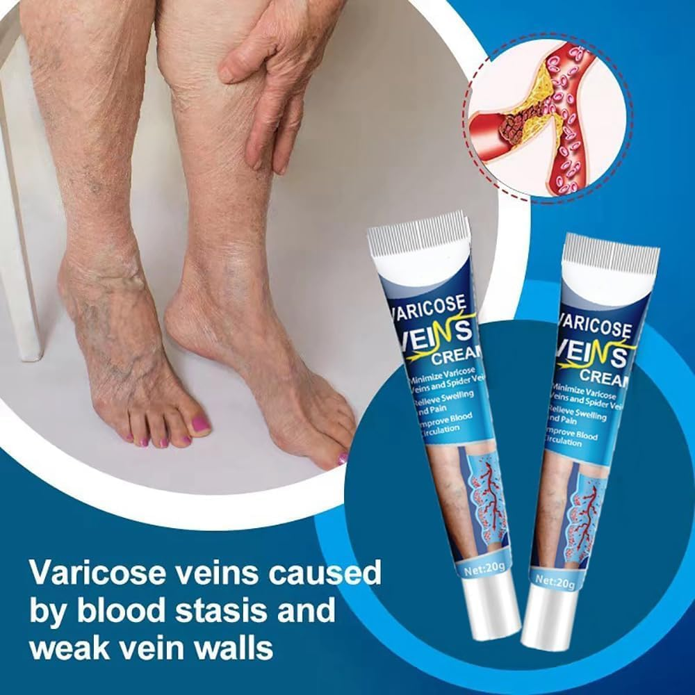 3Pcs GFOUK Mucopolysaccharide Polysulfate Cream,Varicose Veins Cream,Varicose Veins Treatment for Legs,Removal Spider Veins Improve Blood Circulation image number 3