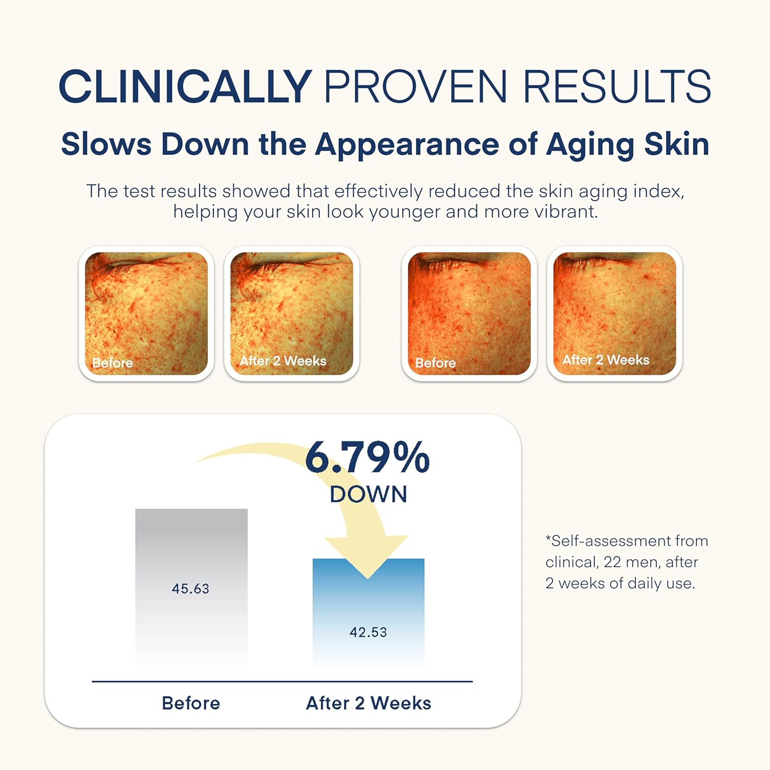 Terez & Honor 6-In-1 Face Cream for Men: Korean Dermforce Anti-Aging Moisturizer with Niacinamide, Bakuchiol & 5-CICA &ndash; Hydrates, Smooths & Helps Reduce Wrinkles, Dark Circles & Eye Bags &ndash; 2.8 Oz image number 6