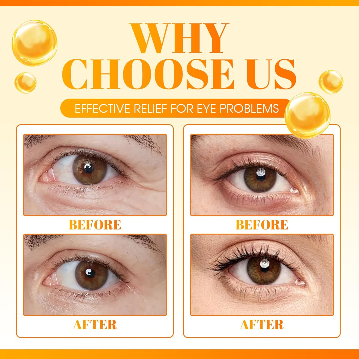 Vc Anti-Wrinkle Eye Serum Oil,Lutein Eye Essence Oil for Women & Men with Roller,Suit for Dark Circles & Puffiness,Firming Anti-Aging,Eye Bags (10 Ml, 2 Pcs) image number 6