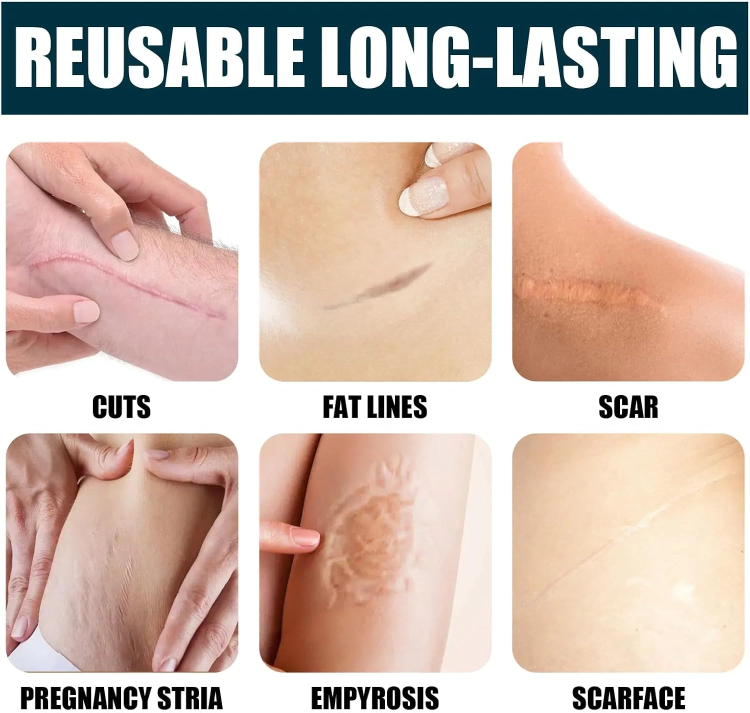 STR- Silicone Scar Removal Gel &ndash; Scar Away Cream for C-Section, Stretch Marks, Acne & Surgery &ndash; Smoothes Old & New Scars &ndash; Fast Absorbing, Hospital-Grade, Painless Formula &ndash; 1.7 Fl Oz'. image number 3