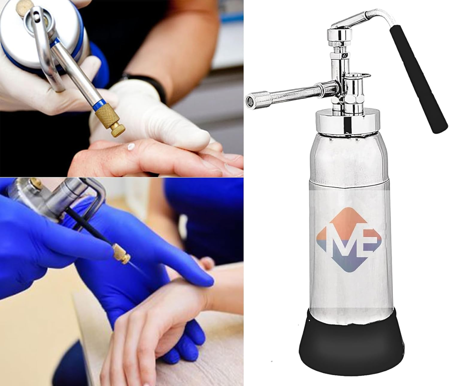 Medirilix Enterprises Dermatology No-1 Mini Cryo Gun Liquid Nitrogen Sprayer, Dermatology Equipment with Free Spray Heads Cryo Can 350 Ml Empty Container image number 3