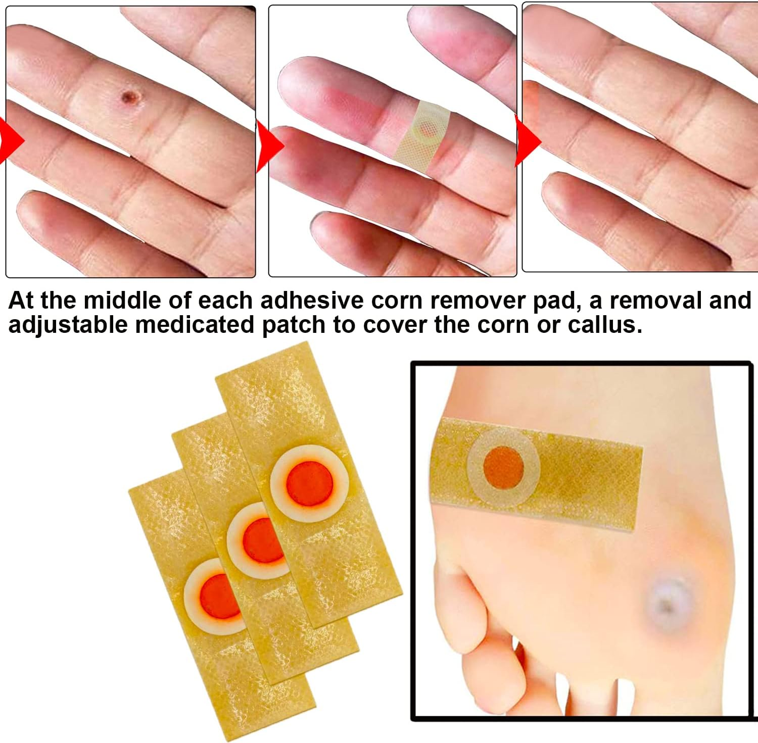 Reppkyh 24 Pieces Corn Removers for Feet, Corn Removers for Toe, Foot Corn-Toe Corn-Callus Removal, Corn Remover Feet image number 2