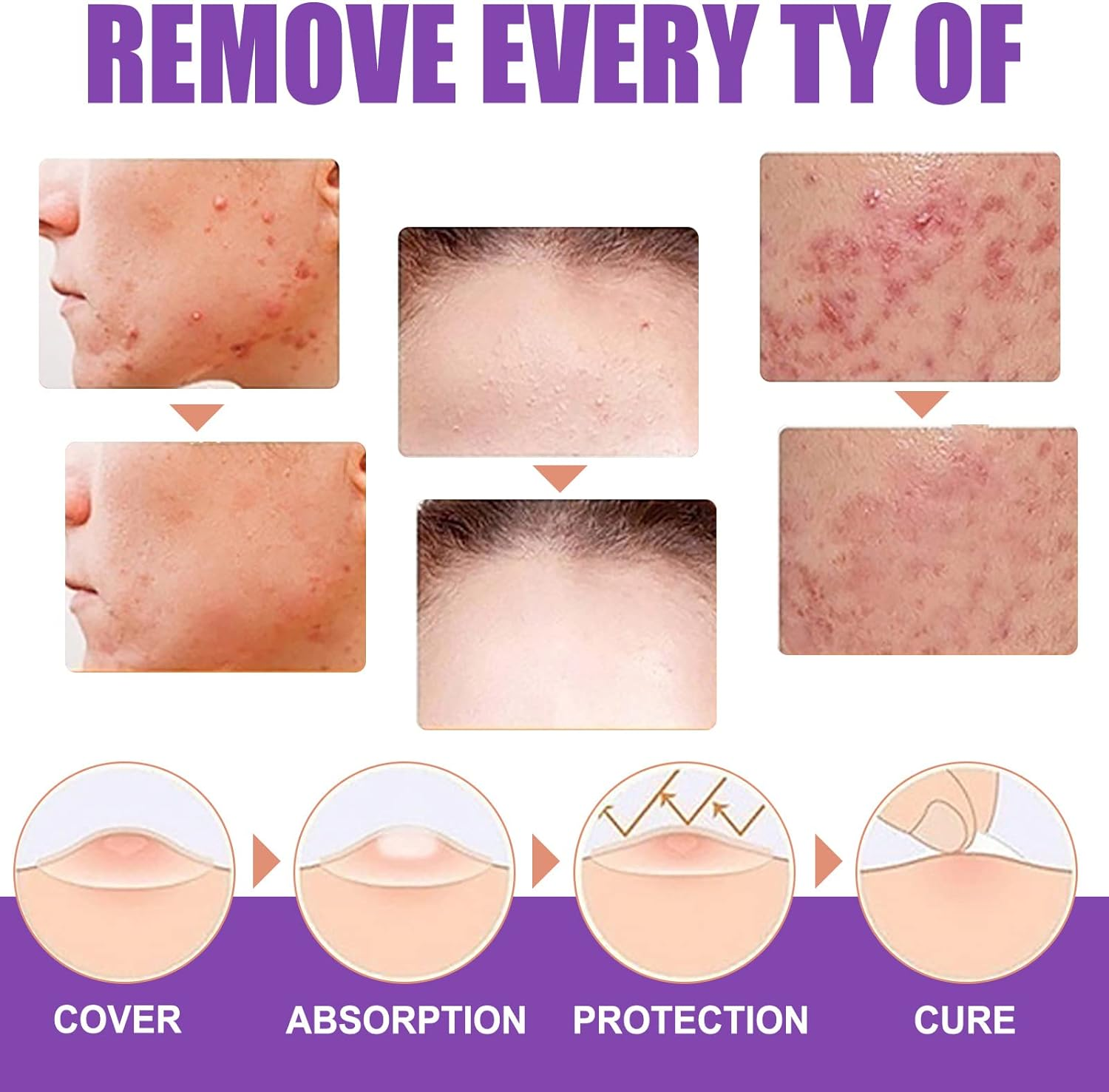 Skin Tag Remover - Professional Grade Fast Acting Liquid for Skin Tags, Moles & Warts Removal - Painless Treatment for Face & Body - 30Ml Easy Application Bottle image number 5