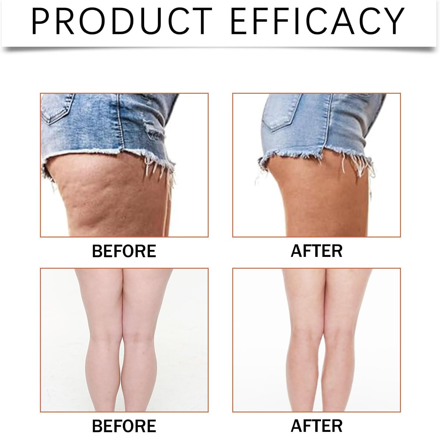 Hey Nip Thigh Lift Tape, Leg Tape for Sagging Skin, Instant Lift Patches for Legs, Lift & Glow Invisible Firming Patches, Thigh Transparent Cellulite Adhesive Body Tape, Waterproof Sweat-Proof (1) image number 1