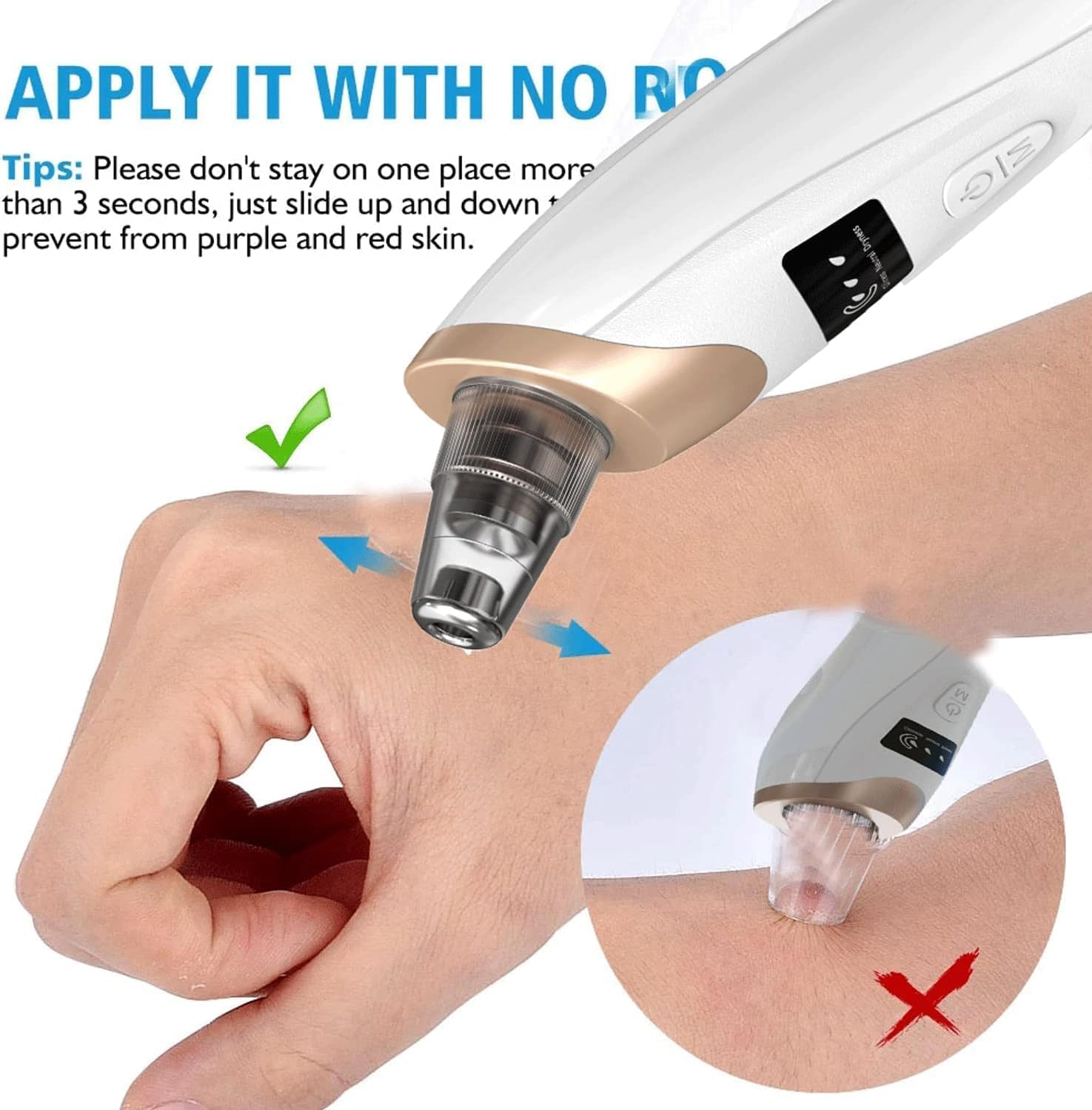 Annuoyi Blackhead Remover Vacuum, with 5 Detachable Facial Cleaning Suction Heads, USB Rechargeable Acne Removal Vacuum Kit, Suitable for Female and Male Facial Skin(White) image number 3