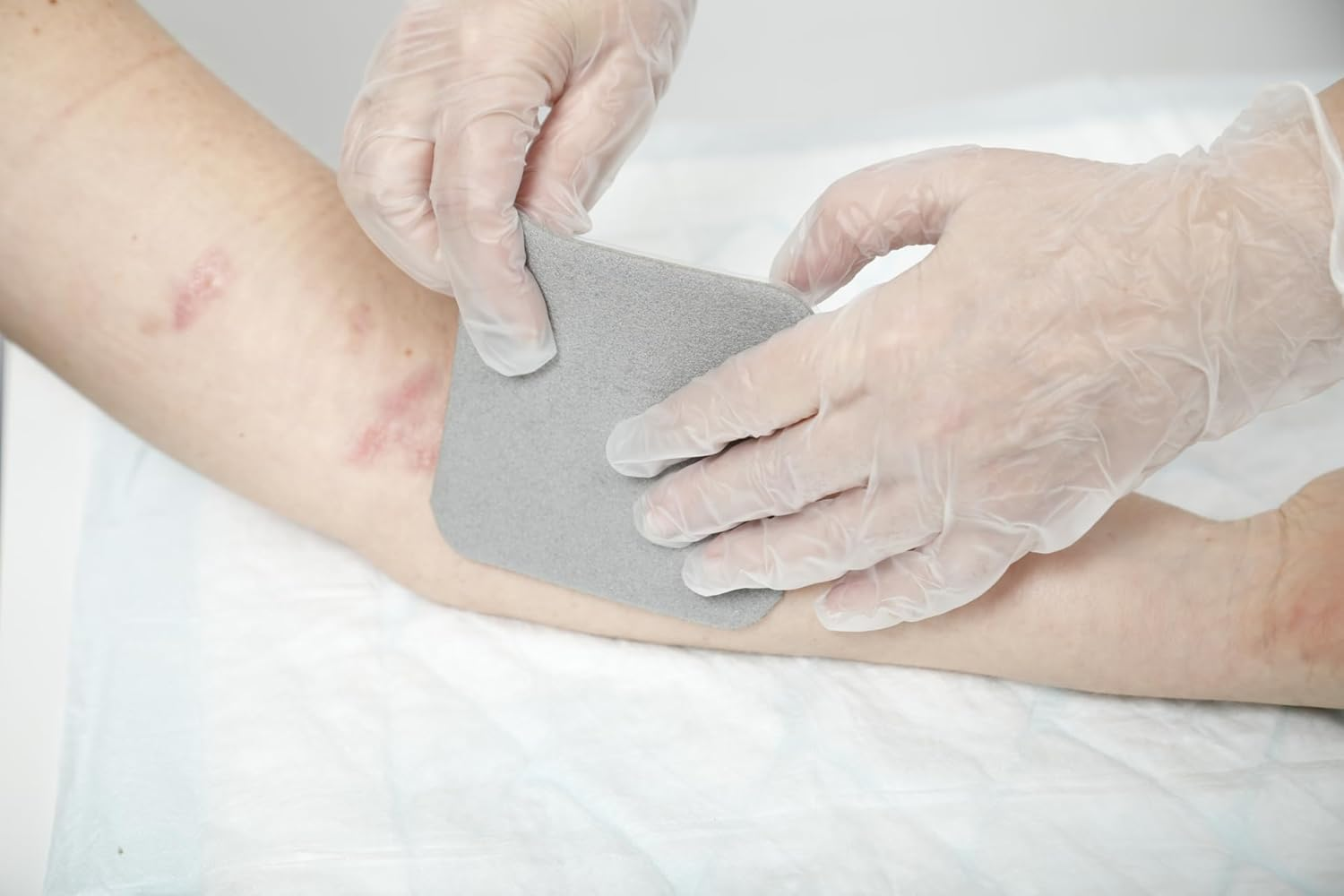 Mepilex Ag 10Cm X 10Cm Box of 5 | Antimicrobial Soft Silicone Silver Foam Dressing | Designed to Stay on for Several Days to Promote a Moist Wound Healing Environment | Clinically Proven Antimicrobial Action for up to 7 Days | Requires a Secondary Retention Bandage Such as Tubifast image number 2