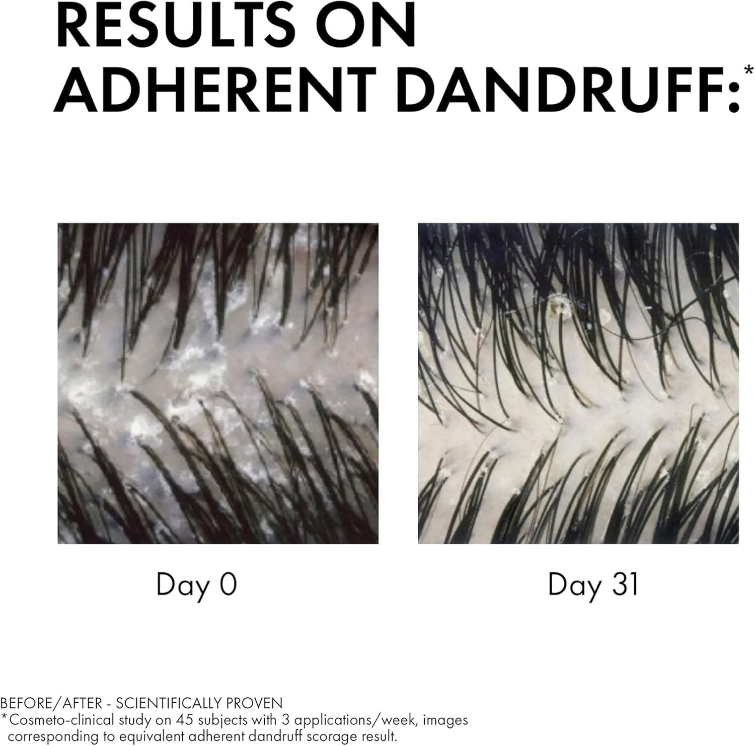 Vichy Dercos Anti-Dandruff Shampoo for Normal to Oily Hair 200Ml, DS Dermatological Shampoo for Sensitive Scalp, Dandruff & Itchy Scalp, Helps Maintain Microbiome & Eliminates Dandruff, Selenium + Salicylic Acid image number 2