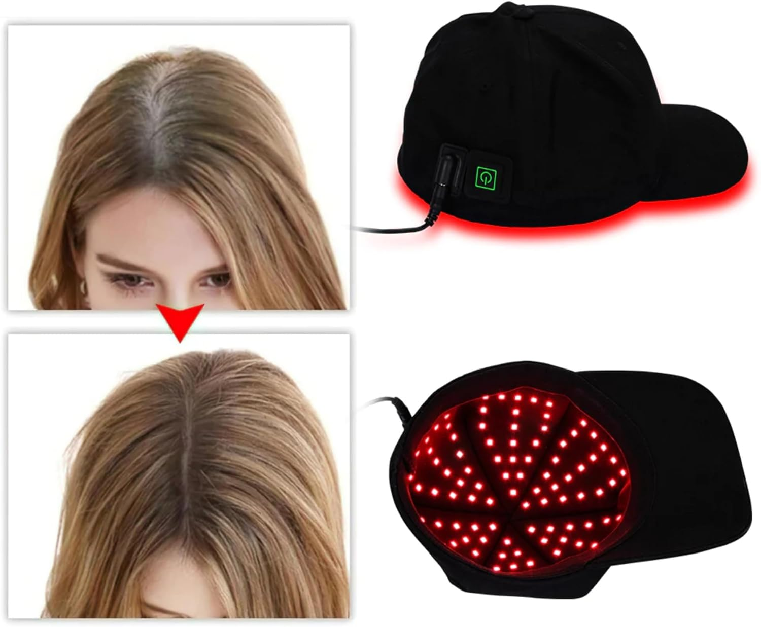 [Femvy] Red LED Light Therapy Cap for Hair Regrowth - 110 LED, Multi-Wavelength, Adjustable Intensity, Fda-Registered image number 2