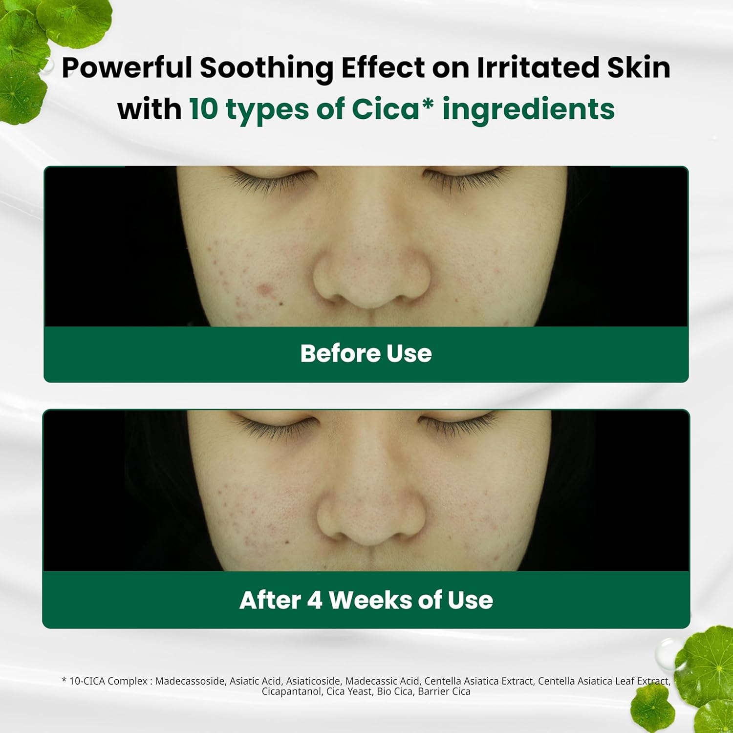 Dr.G R.E.D Blemish Clear Soothing Cream 70 Ml image number 4