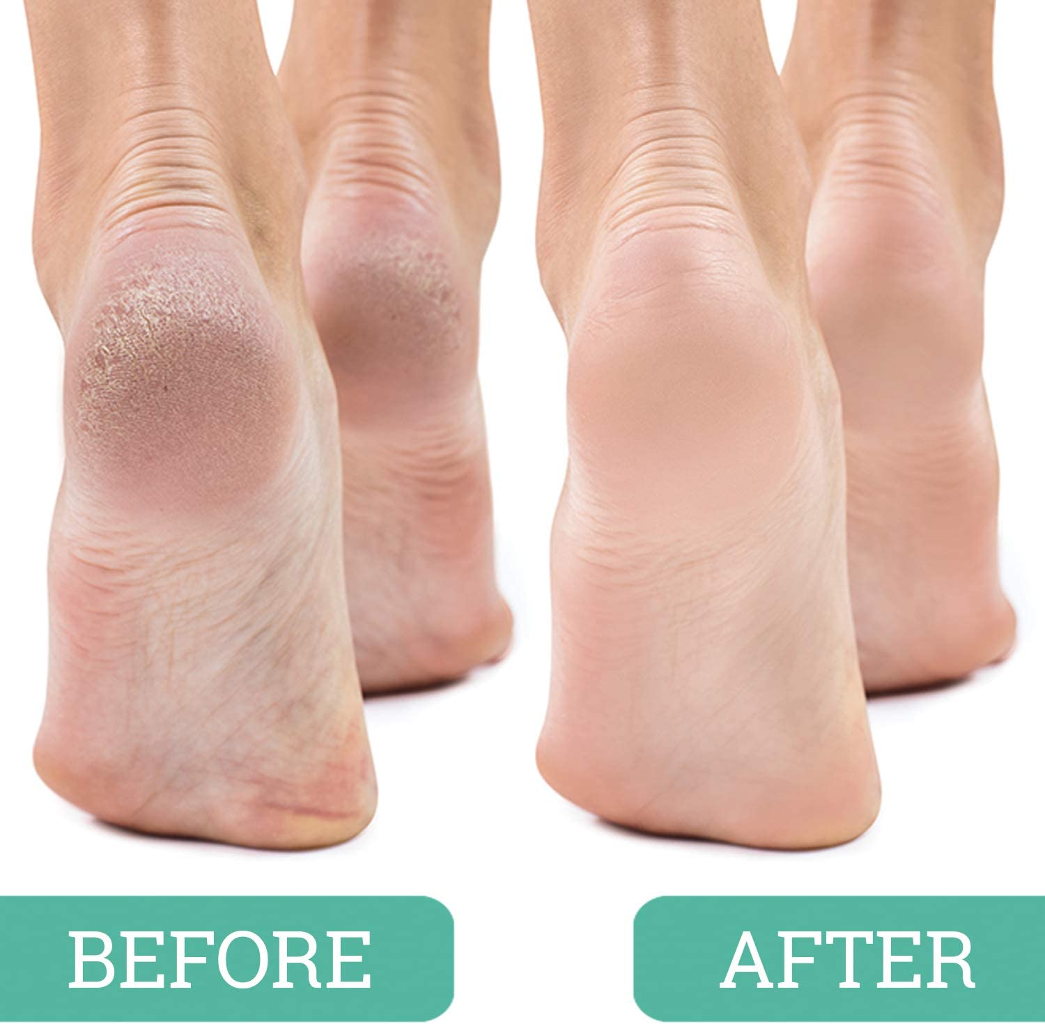 Maccibelle Salon Foot Pumice and Scrubber for Feet and Heels Callus and Dead Skins, Safely and Easily Eliminate Callus and Rough Heels (Pack of 1) image number 5