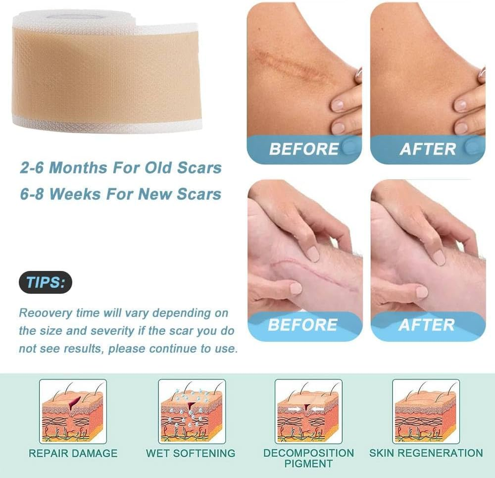 Silicone Scar Sheets, Soft Easy Tear Silicone Scar Tape (1.6"X 120" Roll-3M), Reusable Scar Removal Sheet, Scar Removal Away Strips for Surgical Scars, Keloid Scars, C-Section, Tummy Tuck, Acne Etc. image number 3