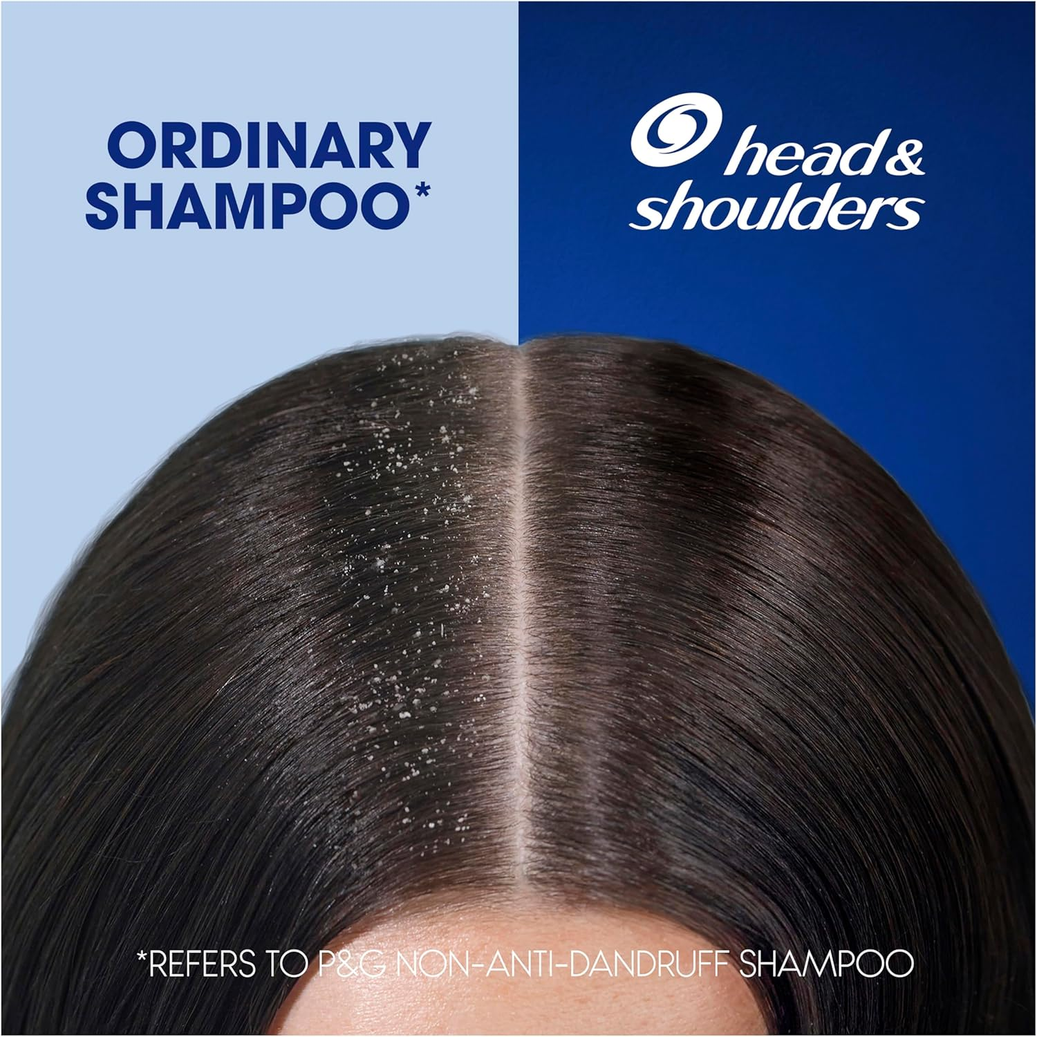 Head & Shoulders Ultra Men 2-In-1 Moisture Recharge Anti-Dandruff Shampoo and Conditioner 750 Ml image number 6