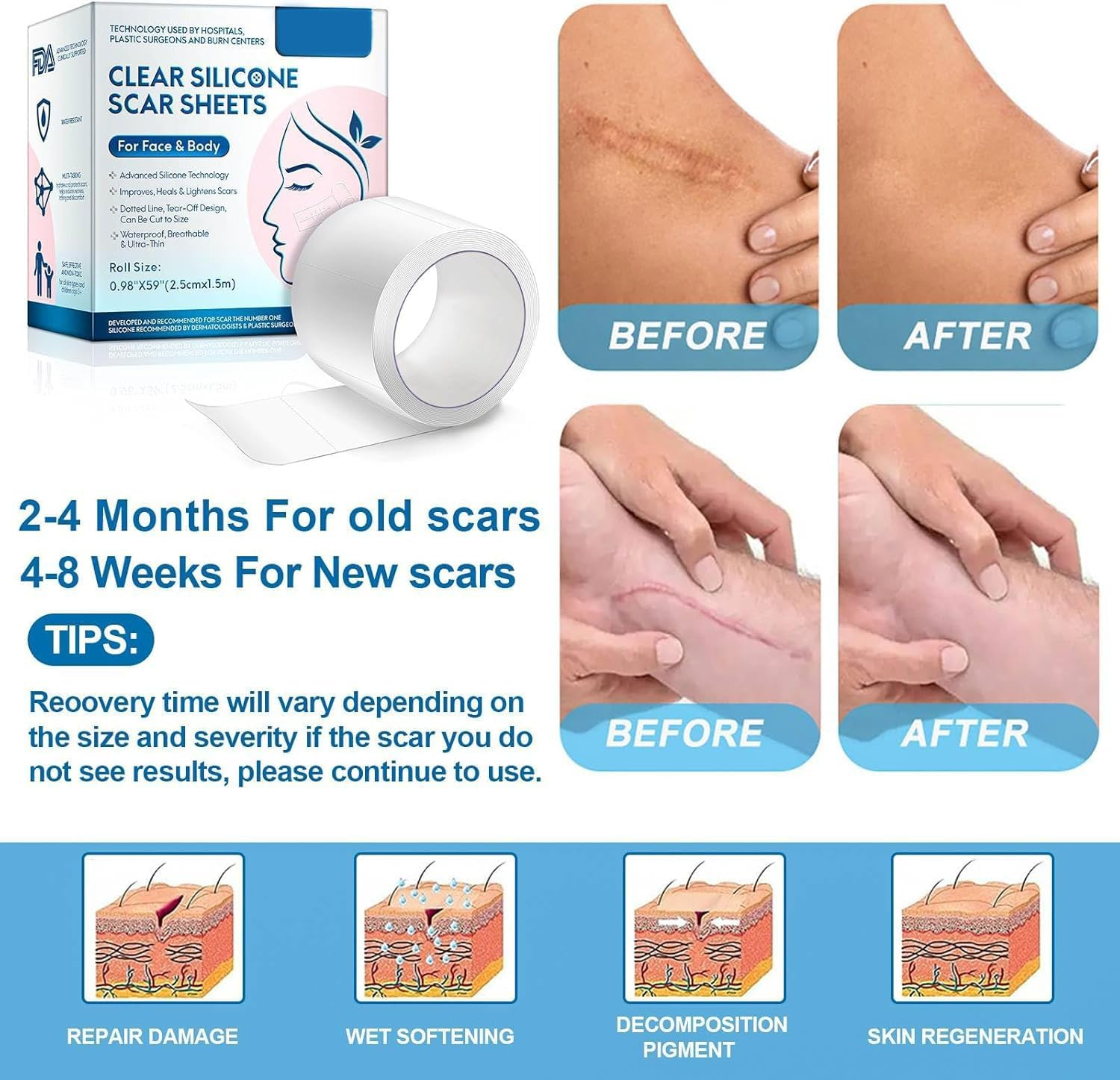 Silicone Scar Sheets, Professional Scar Tape(2.5 X 150Cm Roll-1.5M), Reusable Scar Removal Sheets, Soft Easy-Tear Silicone Scar Tape for for C-Section, Surgery, Burn, Acne Etc image number 1