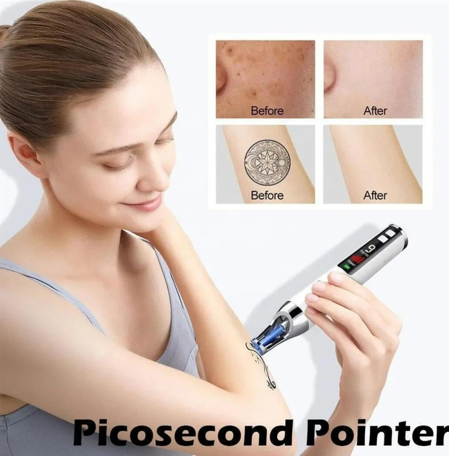 Skin Tag Remover and Wart Remover with Red Light &ndash; Skin Tag Removal Device for Face and Body, 9 Adjustable Strength Levels, Rechargeable Professional Beauty Tool for Safe & Effective Home Use image number 6