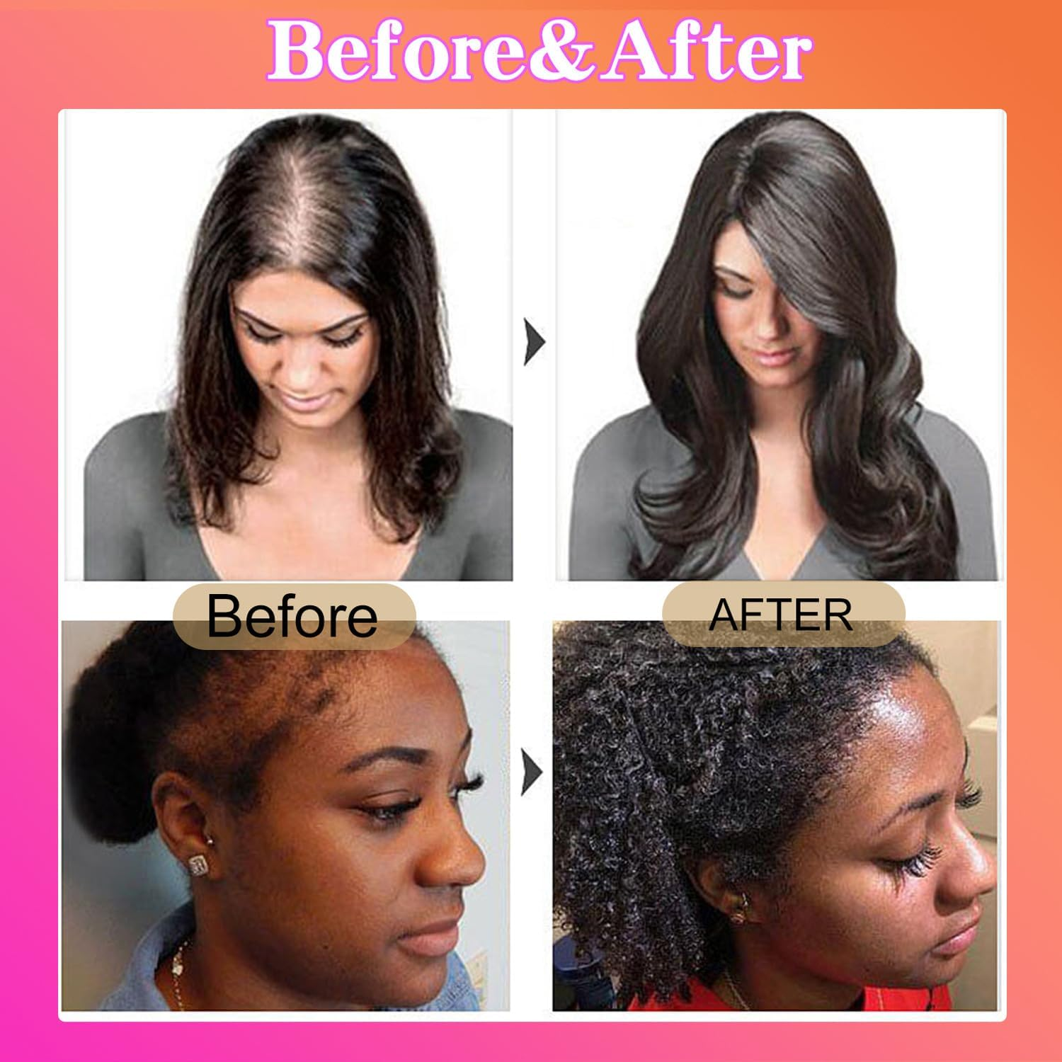 Keyoma Batana Oil for Hair Growth - Organic Conditioner for Healthy Hair