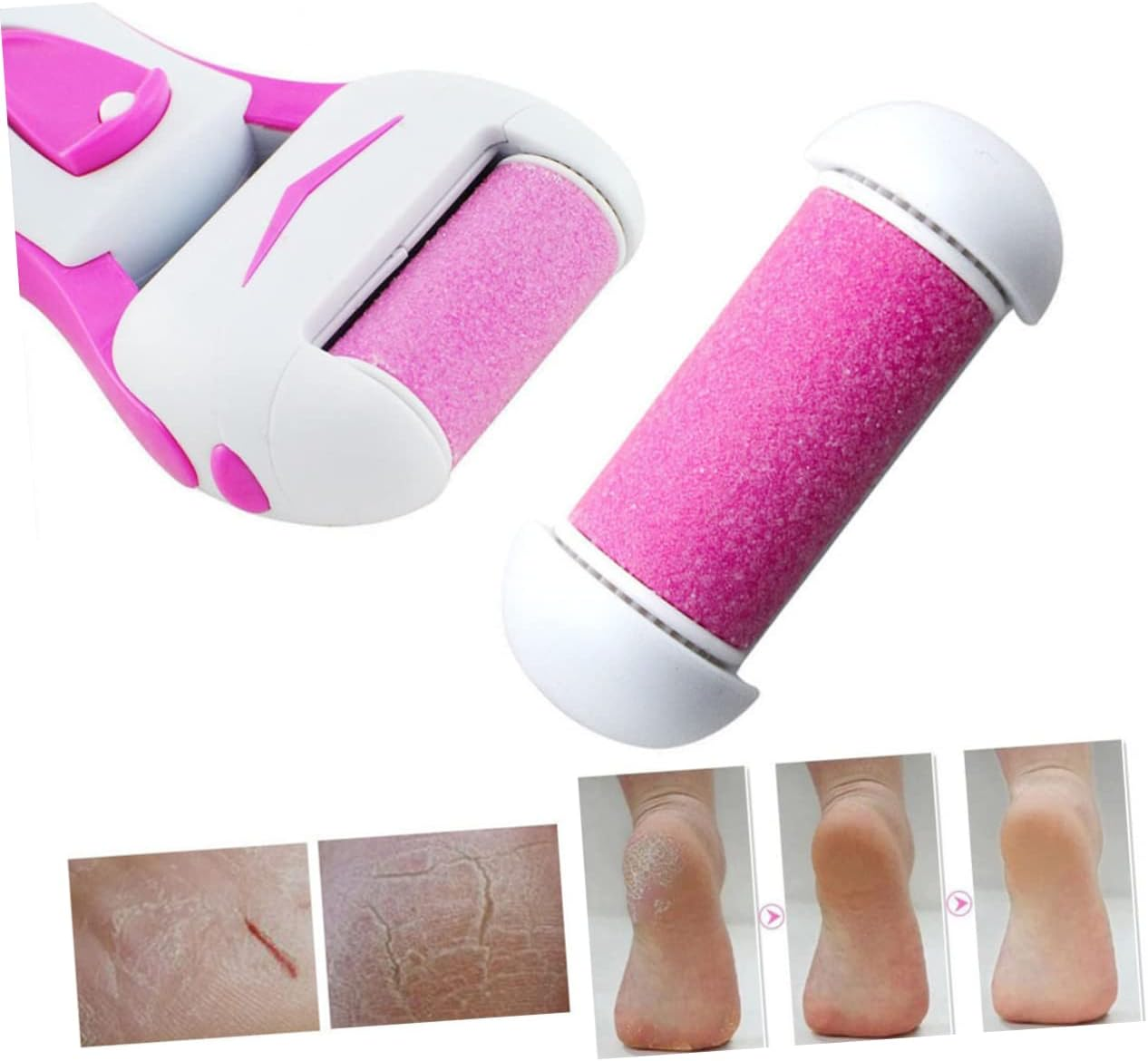 Baluue Replacement Roller for Foot Care Device Abs Plastic Foot Grinding Tool Roller Heads image number 3