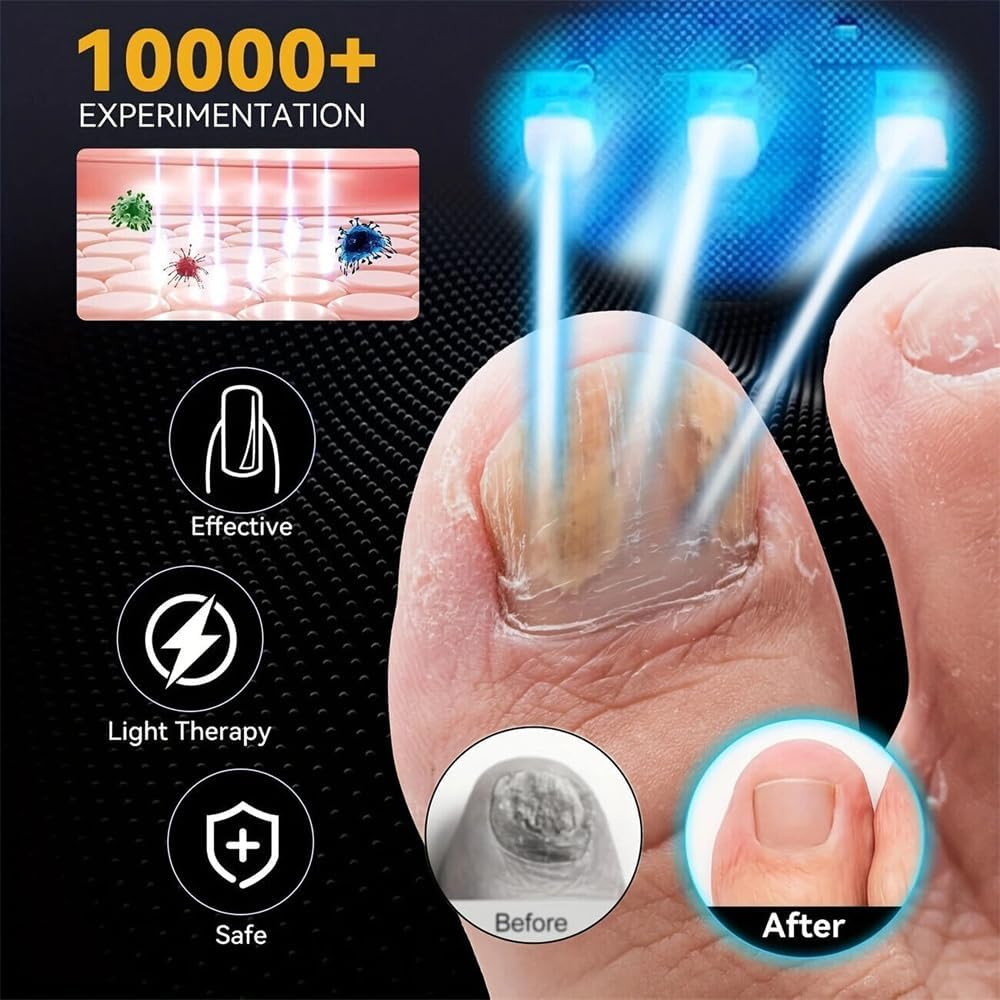 Nail Fungus Cleaning Laser Device Blue Light Nail Therapy for Fingernail Toenail