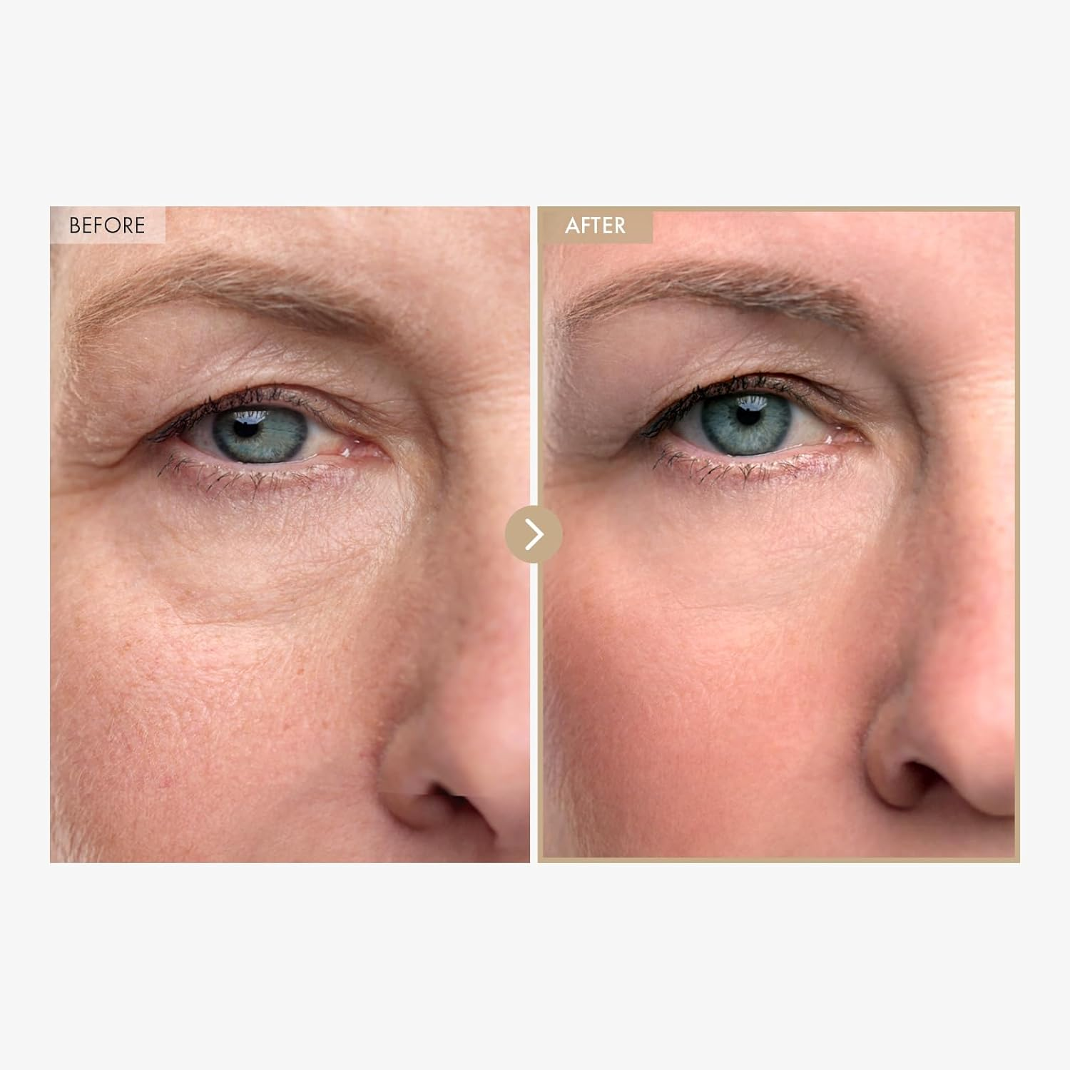 TOSOWOONG Carnosine Lifting Serum, for Wrinkle Care, Hydrating with Collagen Extract, Adenosine for All Skin Types, Korean Skin Care 50G, 1.76 Oz.