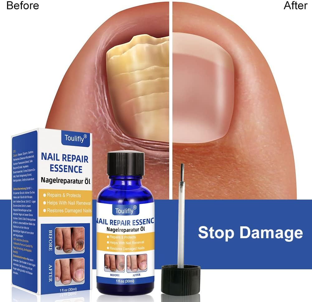 Nail Care and Treatment, Nail Repair, Nail Care for Healthy Foot and Hand, Nail Oil, Nail Care Oil, Nail Care Nourishing, Nail Essence Serum, for Broken and Discoloured Nails image number 4