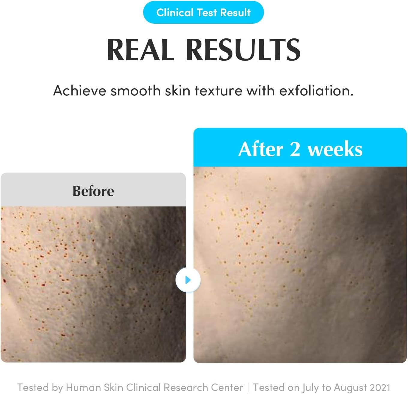 EQQUALBERRY Swimming Pool Daily Facial Toner, 155Ml, 8-Layer Hyaluronic Acid, Low Ph Formula, Enzyme Exfoliation, 5-Berry Complex, Sensitive Skin image number 6