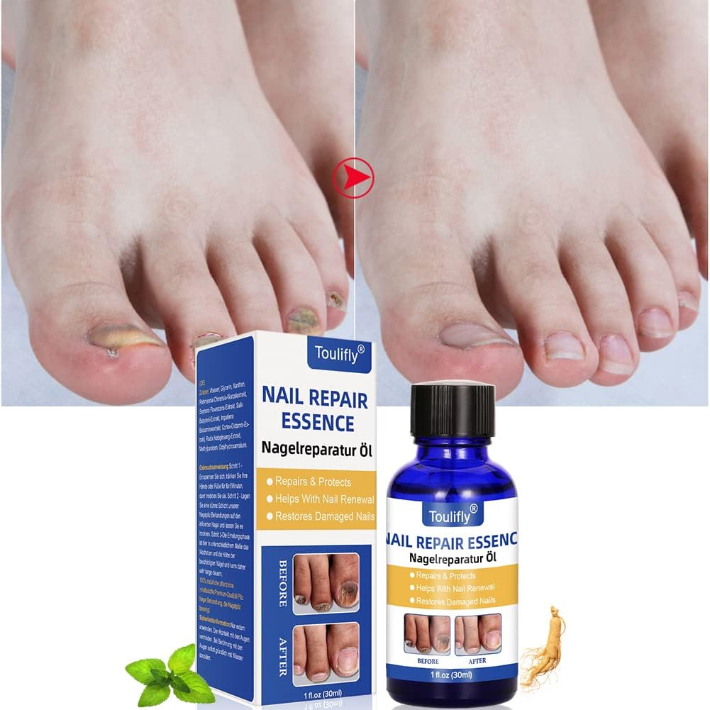 Nail Care and Treatment, Nail Care for Healthy Foot and Hand, Nail Care Oil, Nail Care image number 1
