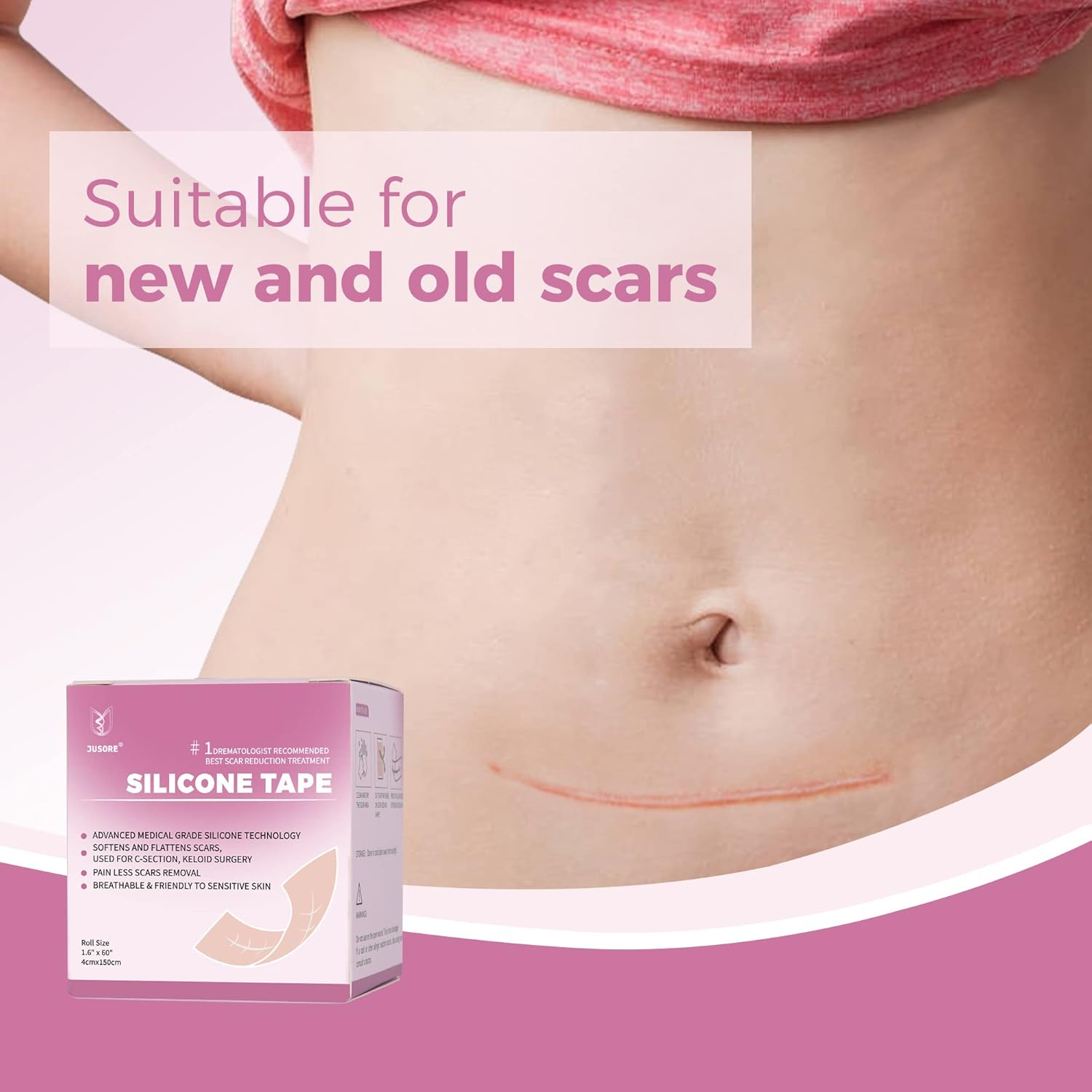 Professional Medical Silicone Scar Tape - Grade Scar Sheets, Non Irritating, Painless for C-Section, Surgical Scars, Burn, Keloid, Acne, Provide Safe and Effective Solutions(1.6&rdquo; X 60&rdquo; Roll) image number 1