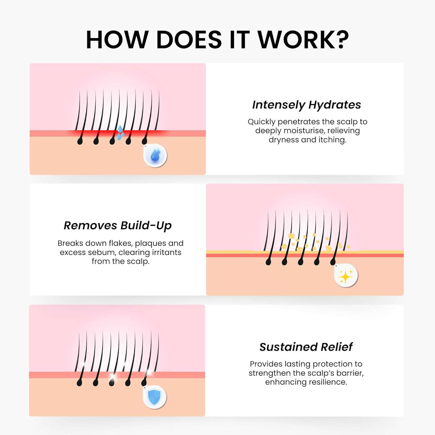 Grahams Natural Scalp Relief Oil - for Dry, Itchy & Flaky Scalp Psoriasis, Seborrheic Dermatitis & Dandruff Treatment - Hydrating, Moisturising, Exfoliating (1 X 100 Ml)