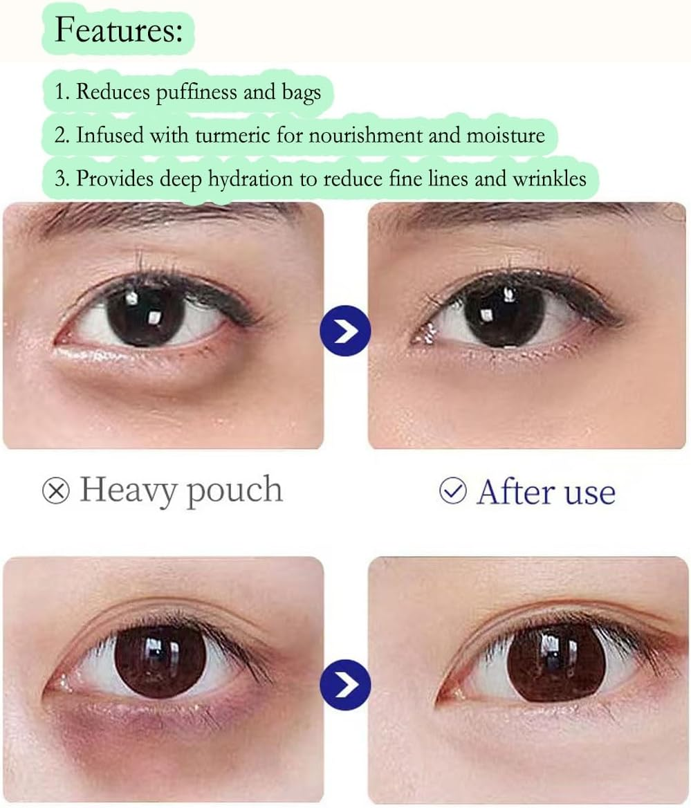 Lumibalm Eye Bags, Lumibalm Eye Serum，Turmeric Eye Cream Stick, Turmeric Retinol Eye Stick, Hydrating Eye Stick, anti Aging under Eye Cream, Reduces Dark Circles and Eye Bags(3Pcs) image number 5