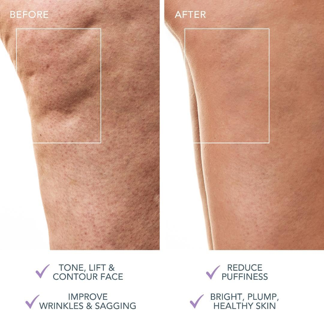 FOREO BEAR 2 Body Advanced Microcurrent Body Sculpting Machine - Cellulite Massager & Lymphatic Drainage - Firm & Contour - Body Massager - Increases Absorption of Skin Care Products - Lavender image number 1