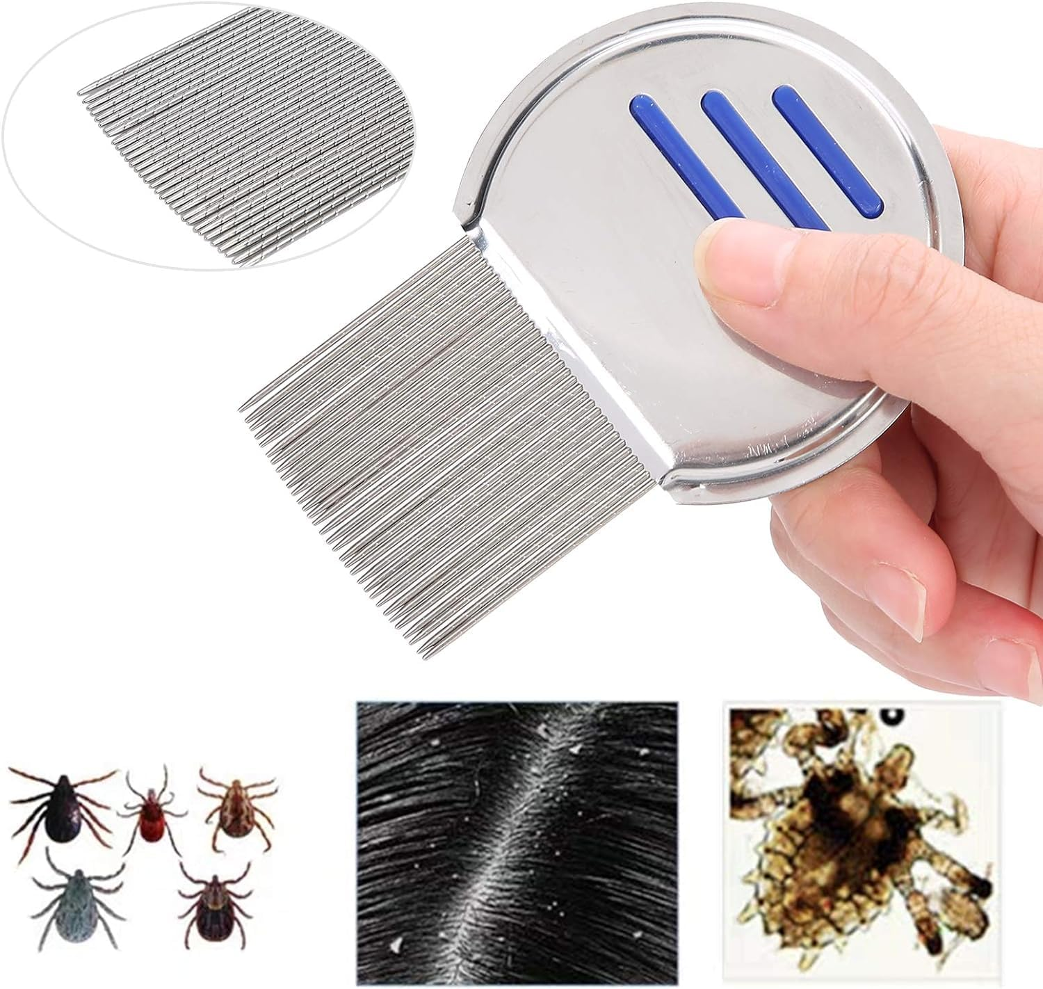 Lice Comb-Professional Stainless Steel Comb- Quick Results for Head Lice Treatment - Suitable for All Hair Types,| Dandruff Comb | Psoriasis Comb-Lice Brush（2 Pack） image number 1