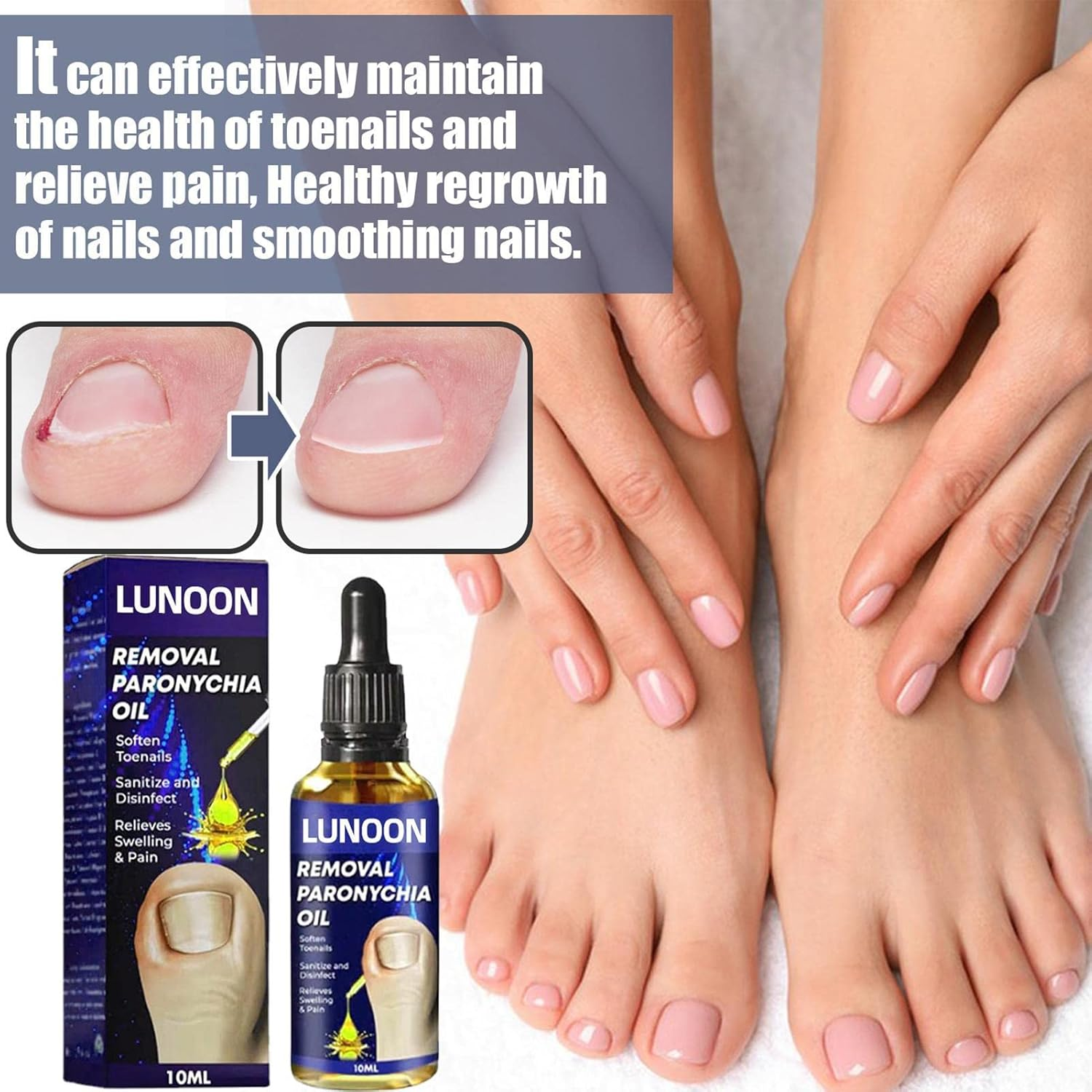 Ingrown Toenail Corrector | Professional Ingrown Toenail Drops Liquid Relief Oil,10Ml Ingrown Toenail Reliever and Softener for Easy Trimming, Toenail Pedicure image number 1