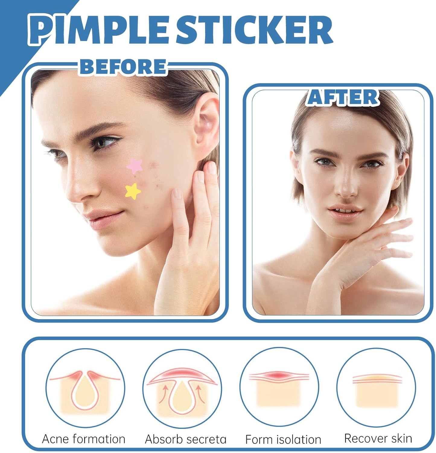 288Pcs Hydrocolloid Acne Patches, Multiple Colors Star Pimple Patch Pimple Patches, Cute Acne Patches in Multiple Sizes for Day and Night (2 Sheets * 4 Patterns)