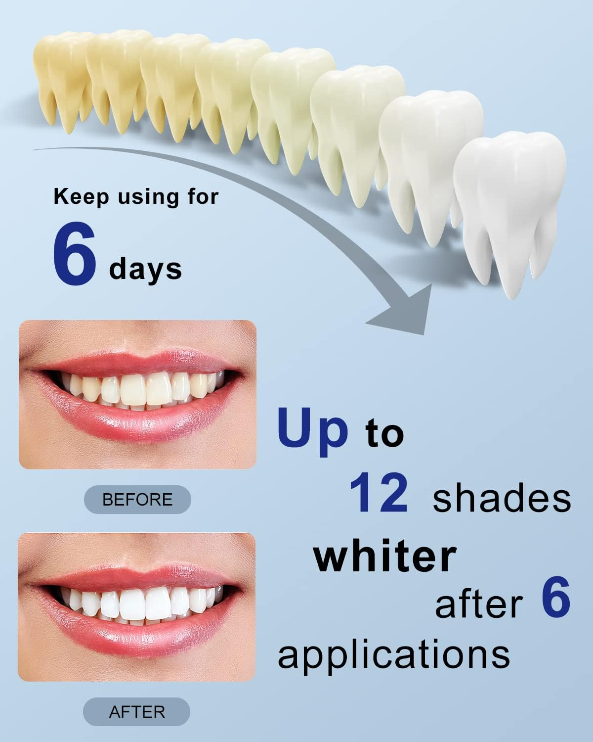 Mysmile Teeth Whitening Kit with 5LED Light, 10 Min Non-Sensitive Fast Teeth Whitener, 3 Packs 3Ml Whitening Gel, Removes Stains from Coffee, Wine, Soda, Food image number 2