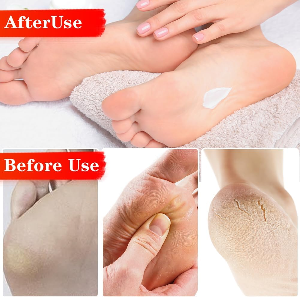 CEWROM Electric Callus Remover with 4 Nano Glass Attachments, Nail File Sander, 2-In-1 Wireless Professional Pedicure Device, Electronic Foot File for Cracked Heels, Callus, Dead image number 2