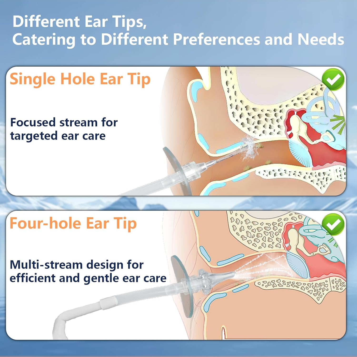 Ear Wax Removal Tool, Ear Cleaning Kits Safe Ear Irrigation Kit Ear Flush Kit for Adults Kids, Ear Wax Washer Device with LED Earwax Spoon, Basin, Bulb, Curette Kit, Towel, Tips, Storage Box Blue