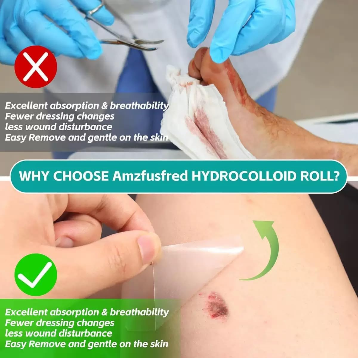 Hydrocolloid Roll for Wound Care, 5Cm*2M Hydrocolloid Bandages Rolls Tape, Waterproof and Ultra Absorbent Patch Bandages Cut-To-Size, First Aid Kit Essential for Burn Blister (Color A) image number 3