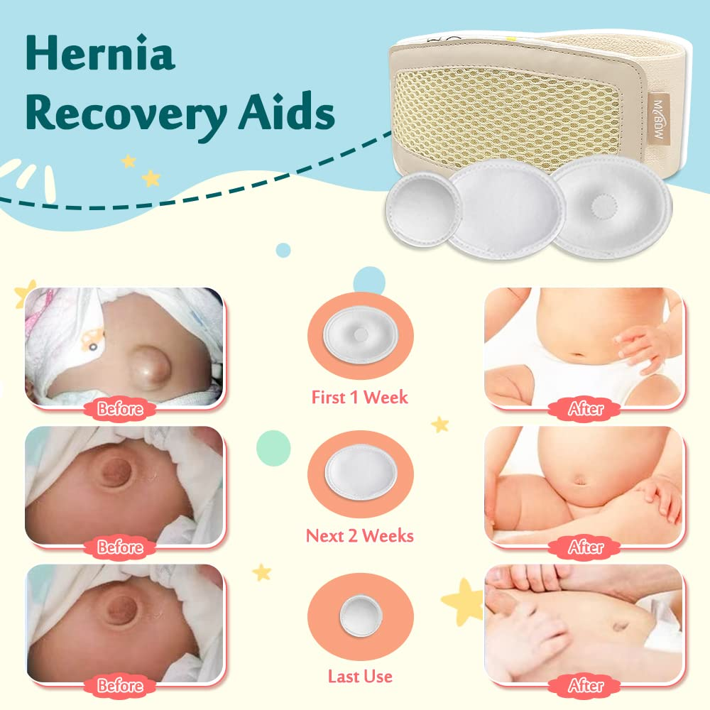 Umbilical Hernia Belt Baby Belly Button Band Newborn Cover Infant Tummy Wrap Umbilical Cord Belt Baby Support Truss Child Adjustable Belly Band Abdominal Navel Relief image number 1