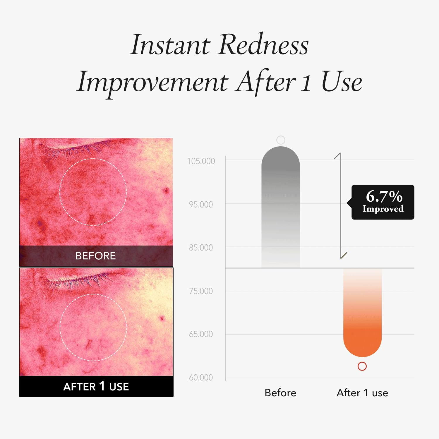 Aprilskin Carrotene IPMP&trade; Instant Calming Serum Toner Pads | 5-Minute Cooling Serum Pads | Vegan, Cruelty-Free | Non-Comedogenic | Toner-Serum-Sheet Mask All-In-One | Korean Skin Care, 80 Pads image number 4