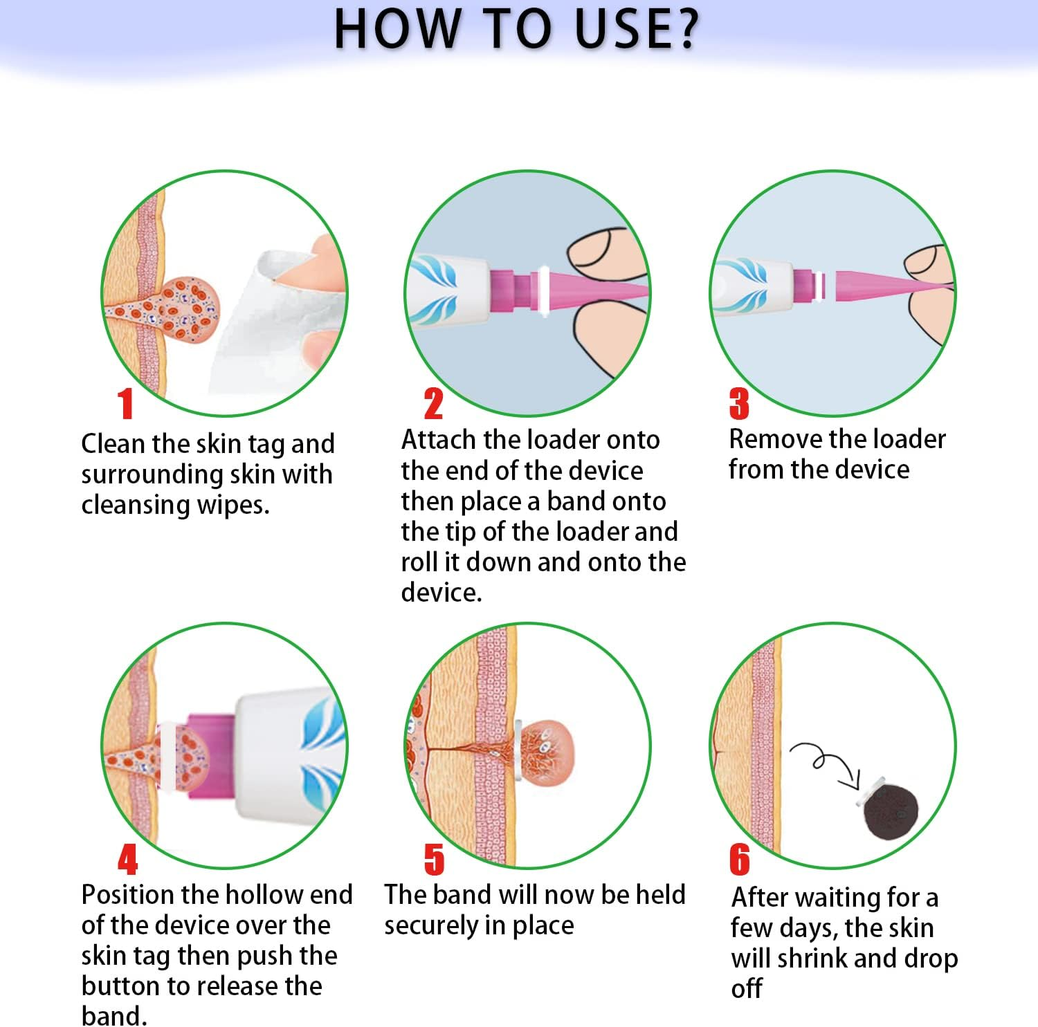 Auto Skin Tag Removal Pen - Remover 2 in 1 Standard and Micro 36Pcs Repair Patches Safe for Small to Large (2Mm to 8Mm) Sized Skin Tags for Most Body (Auto Blue) - Auto Blue image number 3